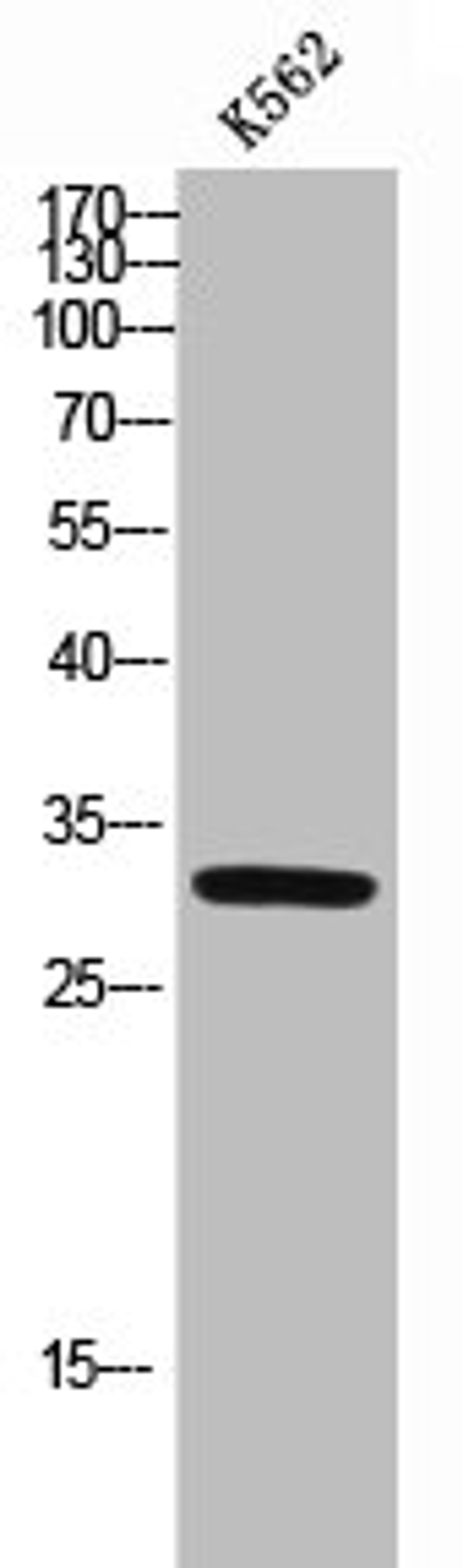 Western Blot analysis of K562 cells using p57 Polyclonal Antibody
