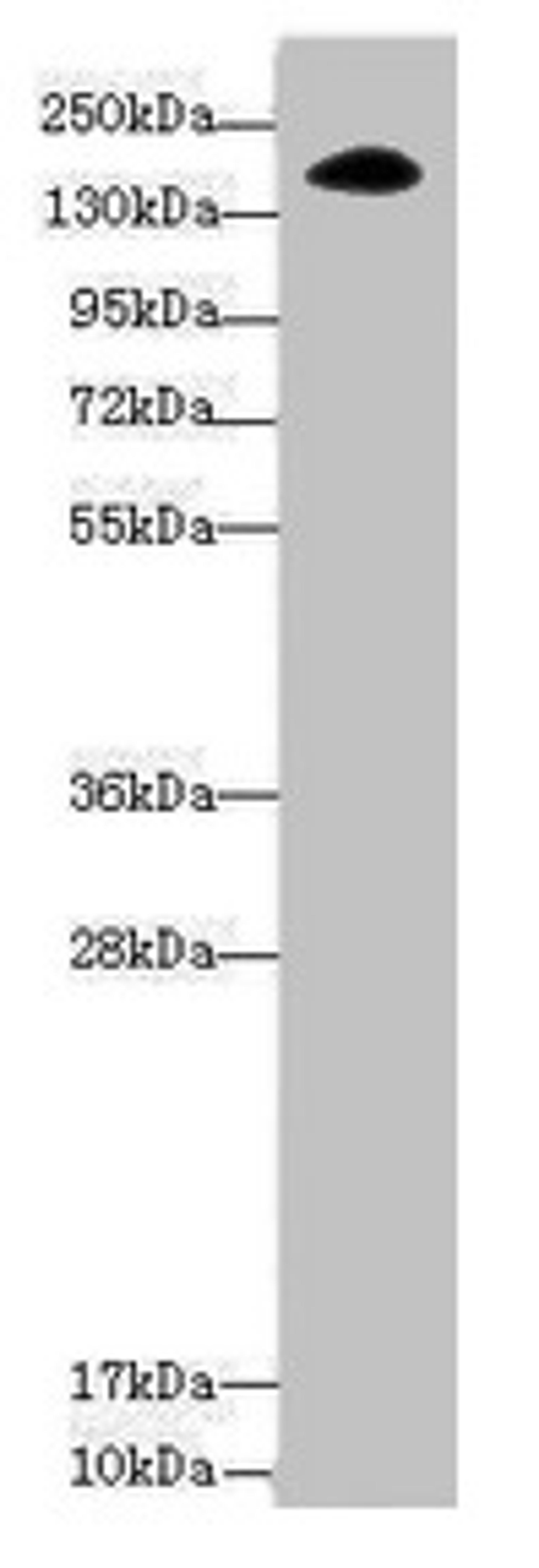 Western blot. All lanes: NUP155 antibody at 3.47µg/ml + Hela whole cell lysate. Secondary. Goat polyclonal to rabbit IgG at 1/10000 dilution. Predicted band size: 156, 150 kDa. Observed band size: 156 kDa