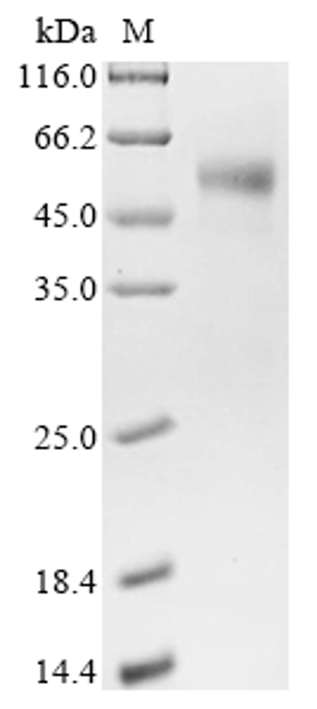 (Tris-Glycine gel) Discontinuous SDS-PAGE (reduced) with 5% enrichment gel and 15% separation gel.