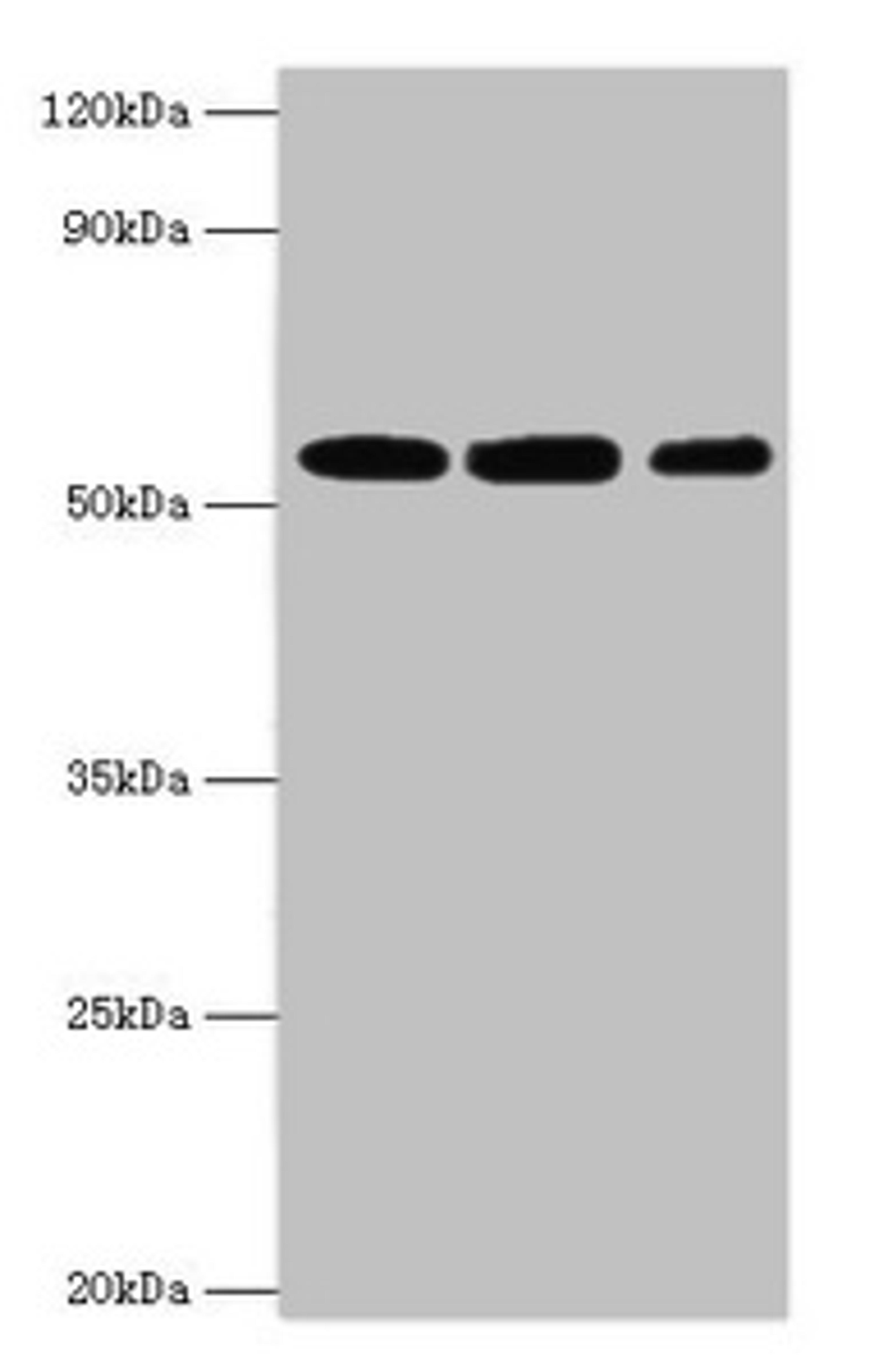 Western blot. All lanes: Nicotinamide phosphoribosyltransferase antibody at 4ug/ml. Lane 1: Mouse heart tissue. Lane 2: Mouse liver tissue. Lane 3: Mouse skeletal muscle tissue. Secondary. Goat polyclonal to rabbit IgG at 1/10000 dilution. Predicted band size: 56 kDa. Observed band size: 56 kDa. 