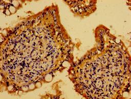 Immunohistochemistry of paraffin-embedded human small intestine tissue using CSB-PA002086LA01HU at dilution of 1:100