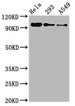 Western Blot. Positive WB detected in Hela whole cell lysate锛?93 whole cell lysate锛孉549 whole cell lysate. All lanes Phospho-FOXO3 antibody at 0.96μg/ml. Secondary. Goat polyclonal to rabbit IgG at 1/50000 dilution. Predicted band size: 97 KDa. Observed band size: 97 KDa. 