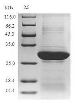 (Tris-Glycine gel) Discontinuous SDS-PAGE (reduced) with 5% enrichment gel and 15% separation gel.