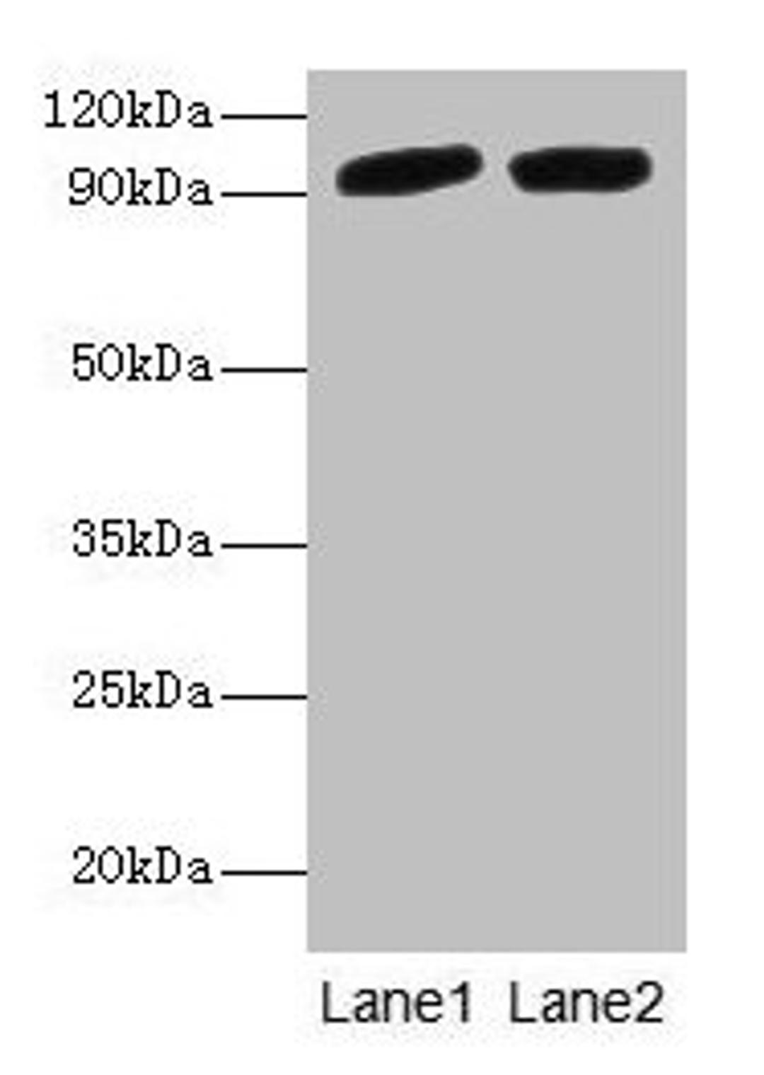 Western blot. All lanes: POSTN antibody at 2µg/ml. Lane 1: Mouse liver tissue. Lane 2: Hela whole cell lysate. Secondary. Goat polyclonal to rabbit IgG at 1/10000 dilution. Predicted band size: 94, 88, 84, 91, 81 kDa. Observed band size: 94 kDa