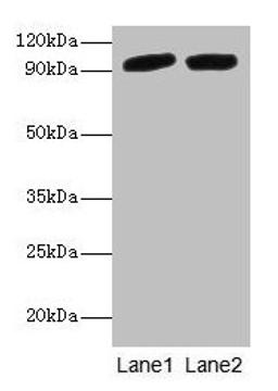 Western blot. All lanes: POSTN antibody at 2µg/ml. Lane 1: Mouse liver tissue. Lane 2: Hela whole cell lysate. Secondary. Goat polyclonal to rabbit IgG at 1/10000 dilution. Predicted band size: 94, 88, 84, 91, 81 kDa. Observed band size: 94 kDa