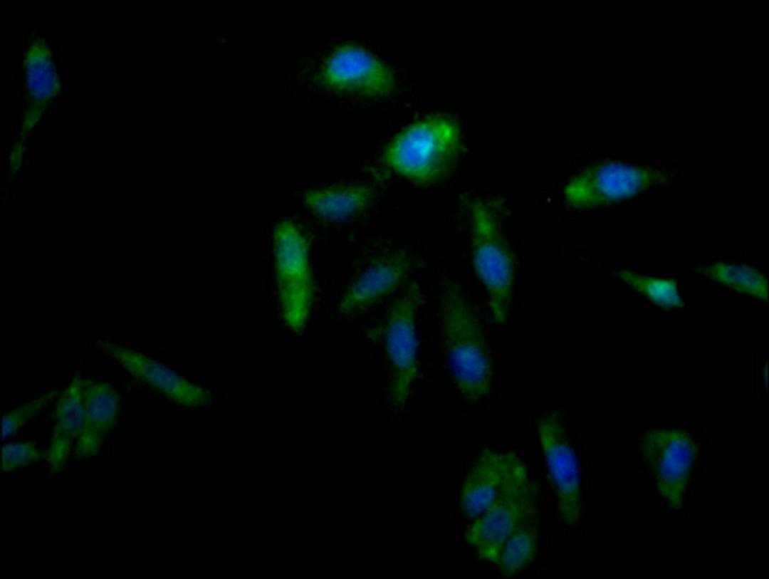 Immunofluorescence staining of Hela Cells with CSB-RA825204A0HU at 1:50, counter-stained with DAPI. The cells were fixed in 4% formaldehyde, permeated by 0.2% TritonX-100, and blocked in 10% normal Goat Serum. The cells were then incubated with the antibody overnight at 4℃. Nuclear DNA was labeled in blue with DAPI. The secondary antibody was FITC-conjugated AffiniPure Goat Anti-Rabbit IgG (H+L).