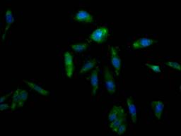 Immunofluorescence staining of Hela Cells with CSB-RA825204A0HU at 1:50, counter-stained with DAPI. The cells were fixed in 4% formaldehyde, permeated by 0.2% TritonX-100, and blocked in 10% normal Goat Serum. The cells were then incubated with the antibody overnight at 4℃. Nuclear DNA was labeled in blue with DAPI. The secondary antibody was FITC-conjugated AffiniPure Goat Anti-Rabbit IgG (H+L).