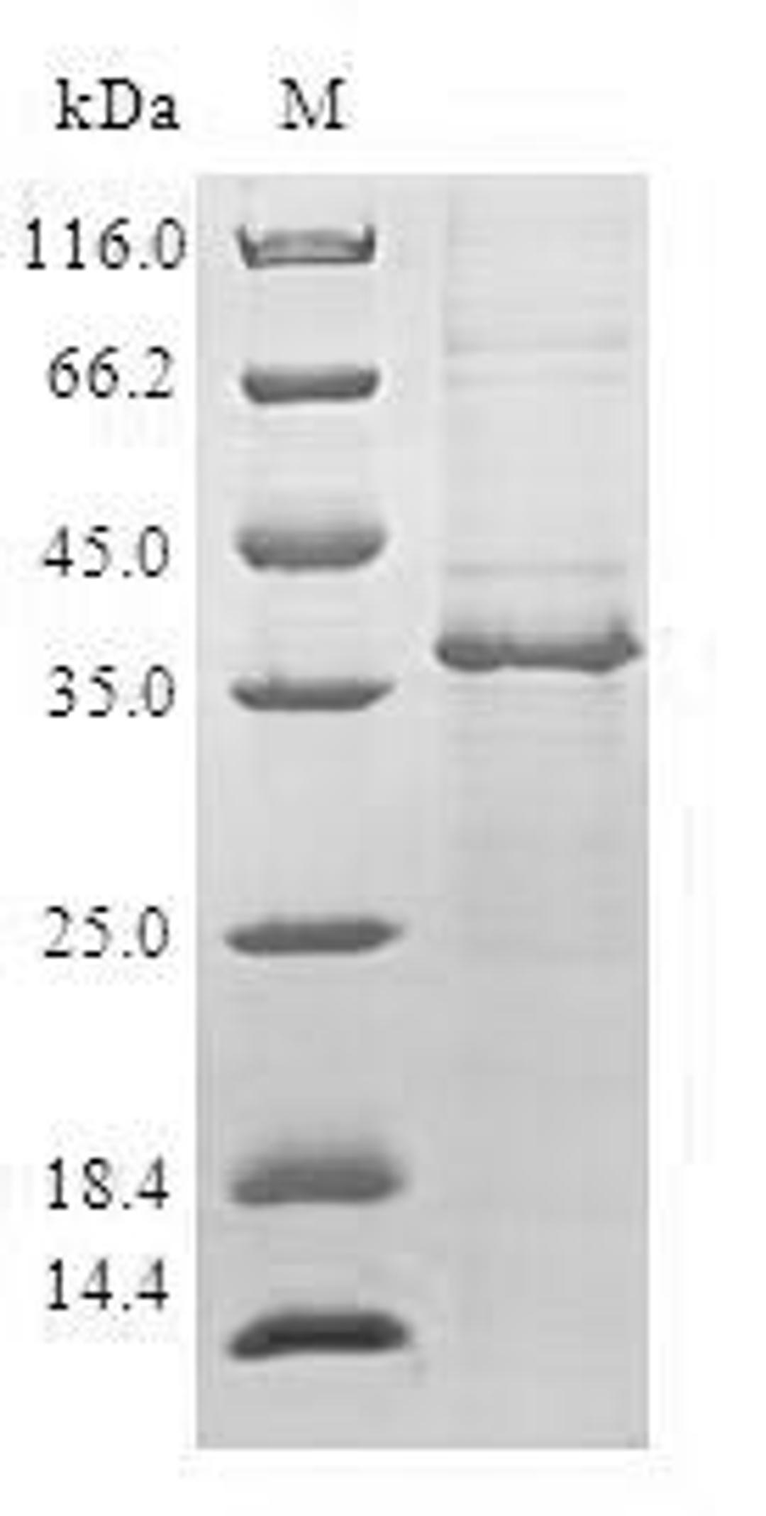 (Tris-Glycine gel) Discontinuous SDS-PAGE (reduced) with 5% enrichment gel and 15% separation gel.