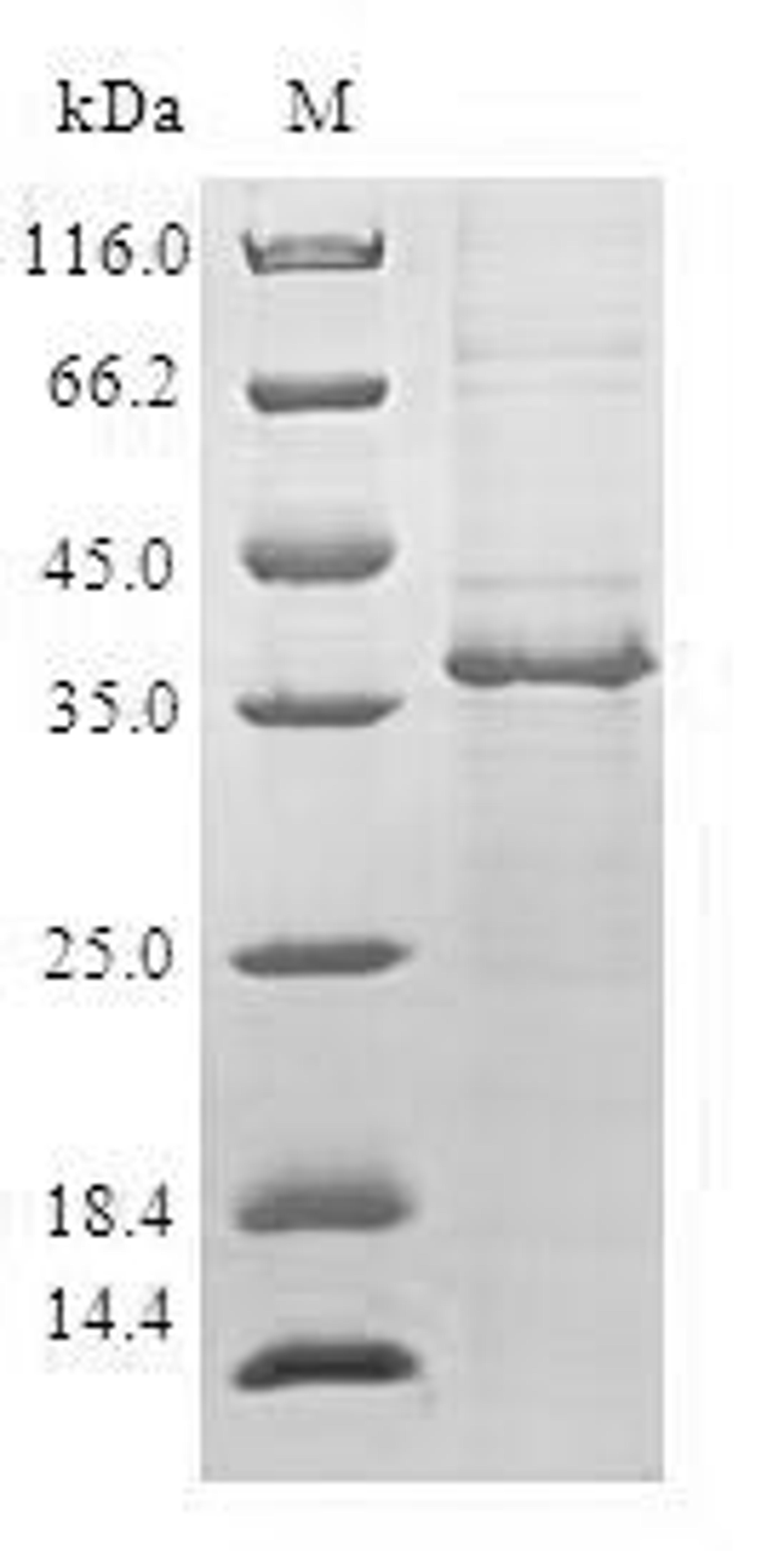 (Tris-Glycine gel) Discontinuous SDS-PAGE (reduced) with 5% enrichment gel and 15% separation gel.