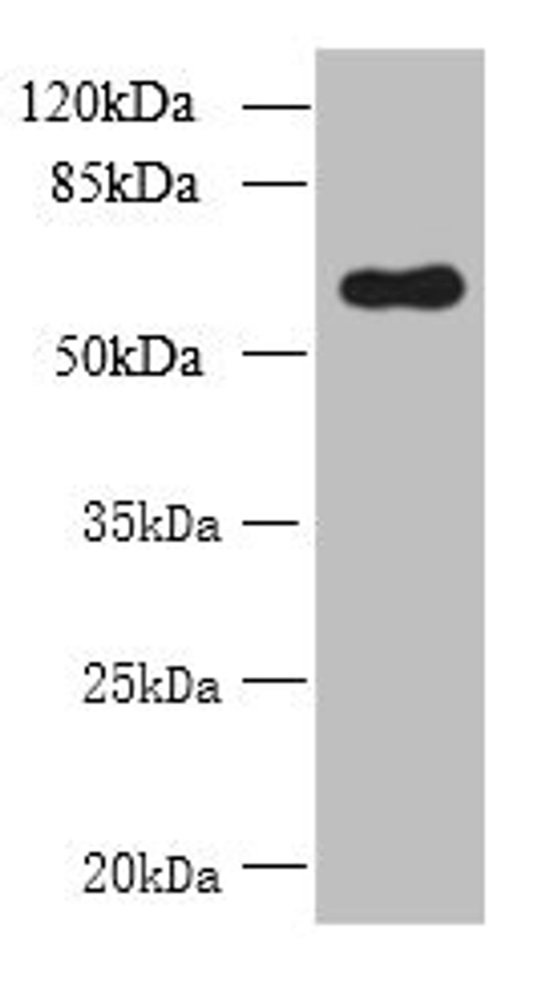 Western blot. All lanes: GDPD2 antibody at 1.5µg/ml + A431 whole cell lysate. Secondary. Goat polyclonal to rabbit IgG at 1/10000 dilution. Predicted band size: 62, 53, 67 kDa. Observed band size: 62 kDa