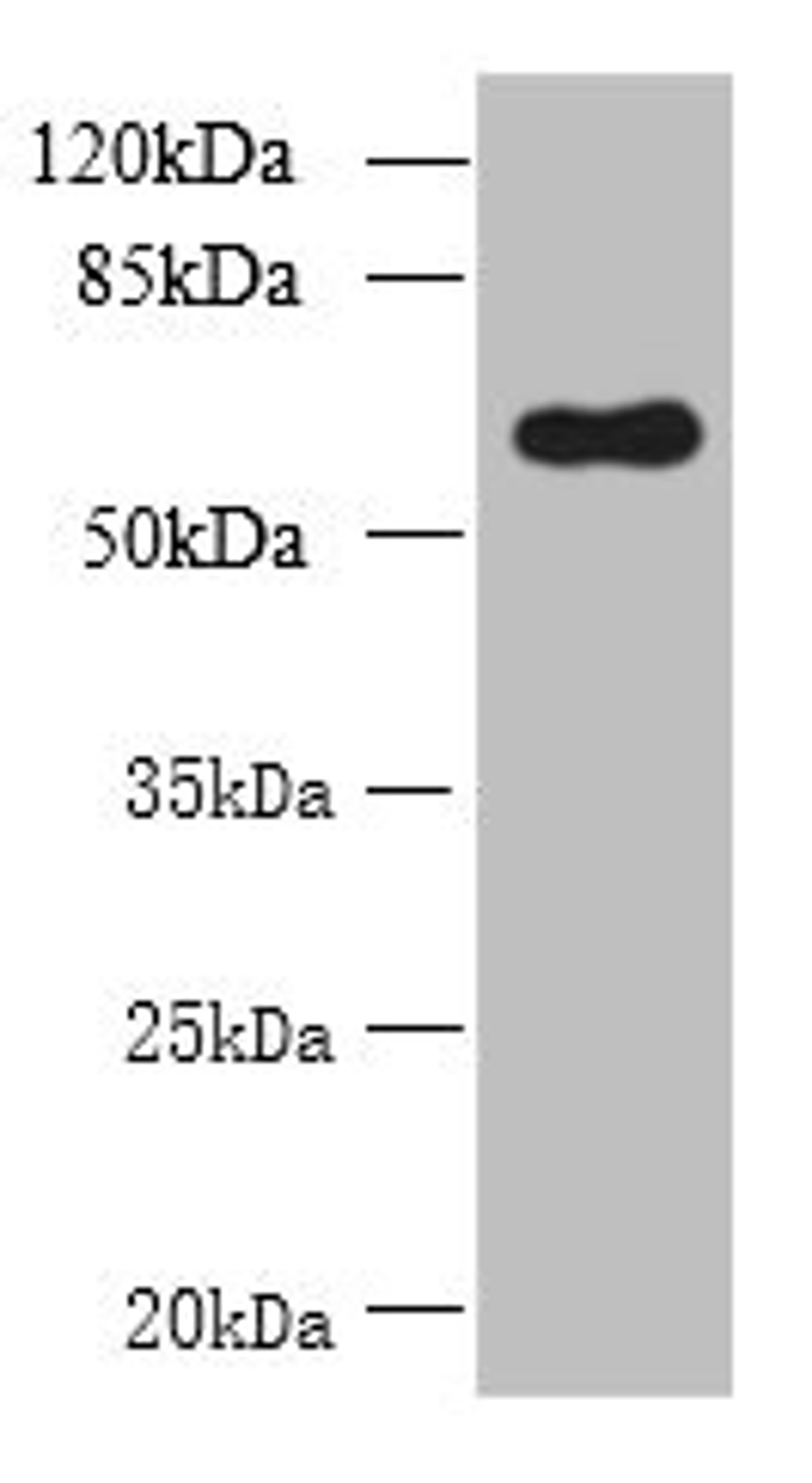 Western blot. All lanes: GDPD2 antibody at 1.5µg/ml + A431 whole cell lysate. Secondary. Goat polyclonal to rabbit IgG at 1/10000 dilution. Predicted band size: 62, 53, 67 kDa. Observed band size: 62 kDa