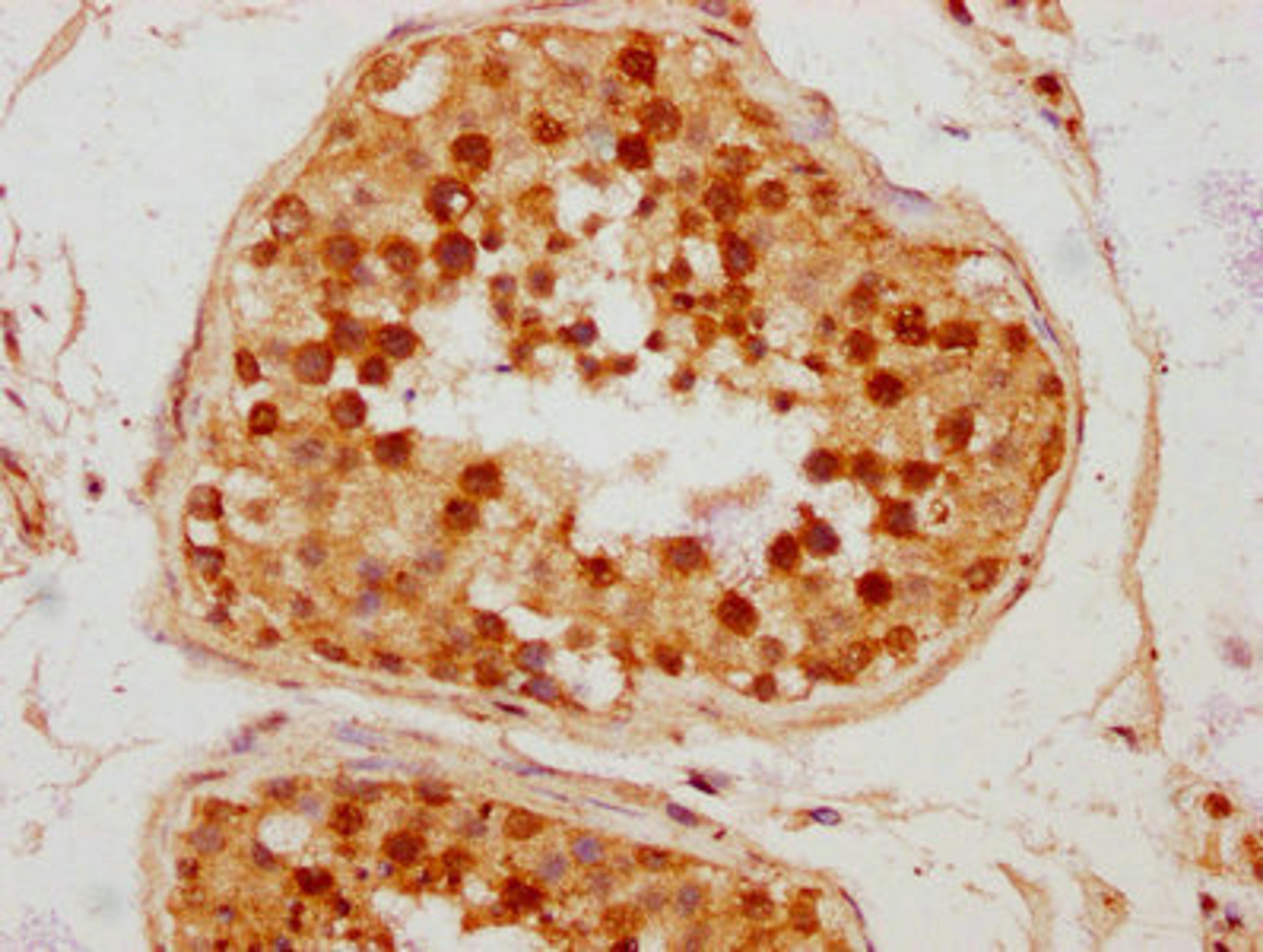 IHC image of CSB-PA688972LA01HU diluted at 1:300 and staining in paraffin-embedded human testis tissue performed on a Leica BondTM system. After dewaxing and hydration, antigen retrieval was mediated by high pressure in a citrate buffer&nbsp;(pH 6.0). Section was blocked with 10% normal goat serum 30min at RT. Then primary antibody&nbsp;(1% BSA) was incubated at 4&deg;C overnight. The primary is detected by a biotinylated secondary antibody and visualized using an HRP conjugated SP system.