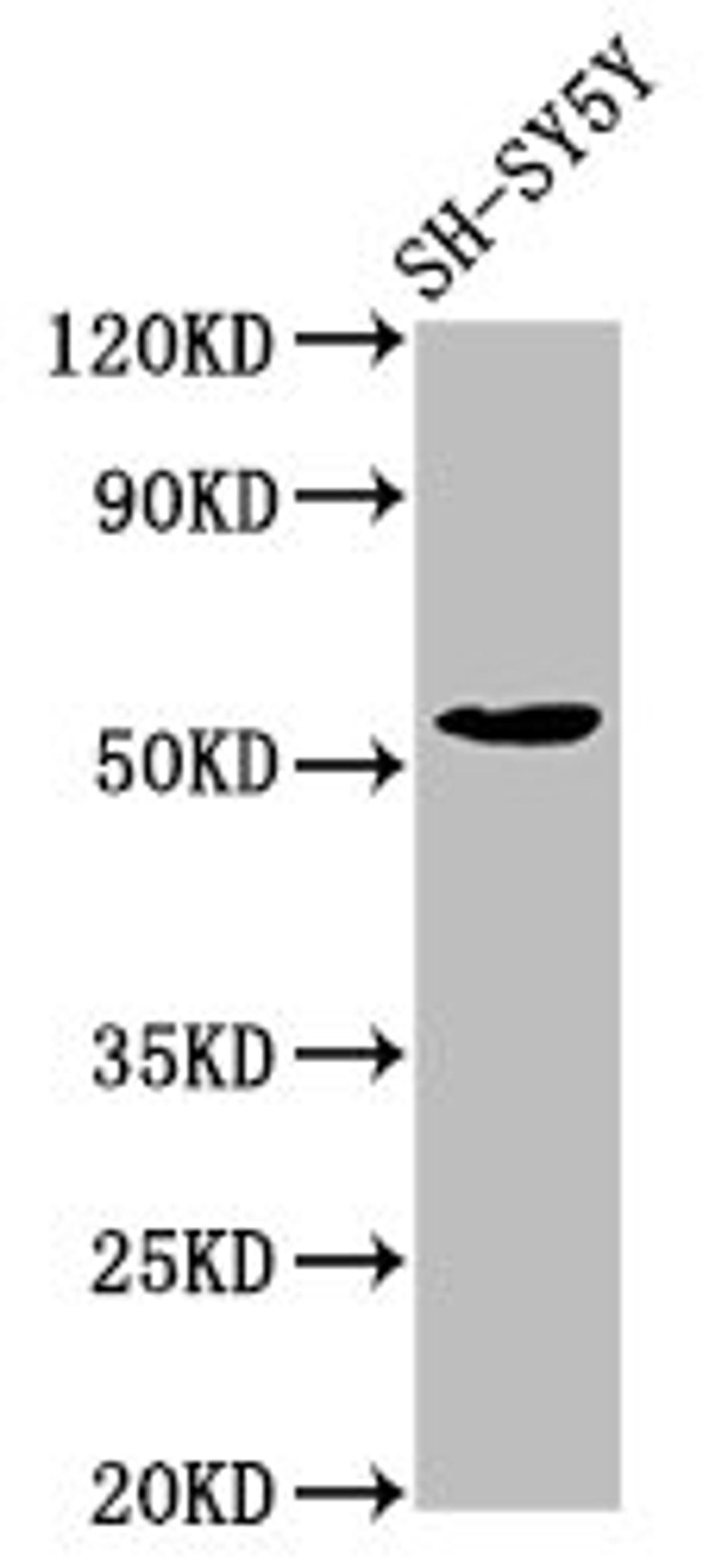 Western Blot. Positive WB detected in: SH-SY5Y whole cell lysate. All lanes: MZF1 antibody at 7.7µg/ml. Secondary. Goat polyclonal to rabbit IgG at 1/50000 dilution. Predicted band size: 83, 55, 32 kDa. Observed band size: 55 kDa