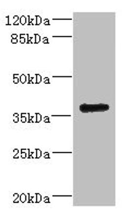 Western blot. All lanes: VSX1 antibody IgG at 2.32ug/ml + 293T whole cell lysate. Secondary. Goat polyclonal to rabbit IgG at 1/10000 dilution. Predicted band size: 39, 25, 40, 15, 30, 23, 25, 33 kDa. Observed band size: 39 kDa. 
