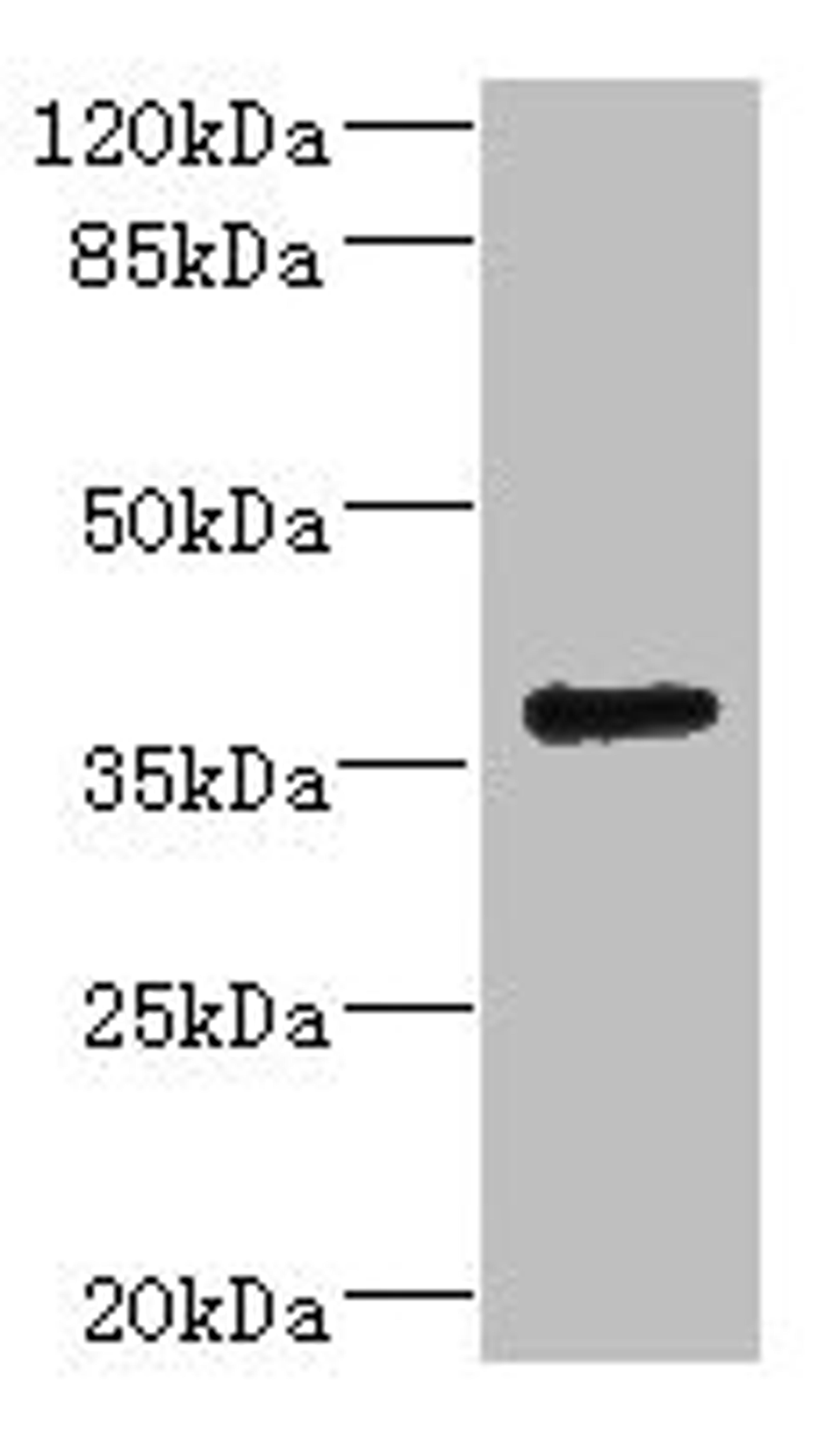 Western blot. All lanes: VSX1 antibody IgG at 2.32ug/ml + 293T whole cell lysate. Secondary. Goat polyclonal to rabbit IgG at 1/10000 dilution. Predicted band size: 39, 25, 40, 15, 30, 23, 25, 33 kDa. Observed band size: 39 kDa. 