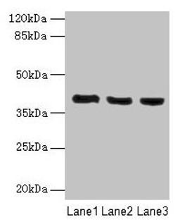 Western blot. All lanes: C9orf64 antibody at 1µg/ml. Lane 1: Hela whole cell lysate. Lane 2: K562 whole cell lysate. Lane 3: HepG2 whole cell lysate. Secondary. Goat polyclonal to rabbit IgG at 1/10000 dilution. Predicted band size: 40 kDa. Observed band size: 40 kDa