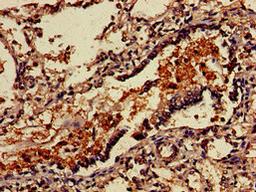 Immunohistochemistry of paraffin-embedded human lung tissue using CSB-PA896869LA01HU at dilution of 1:100