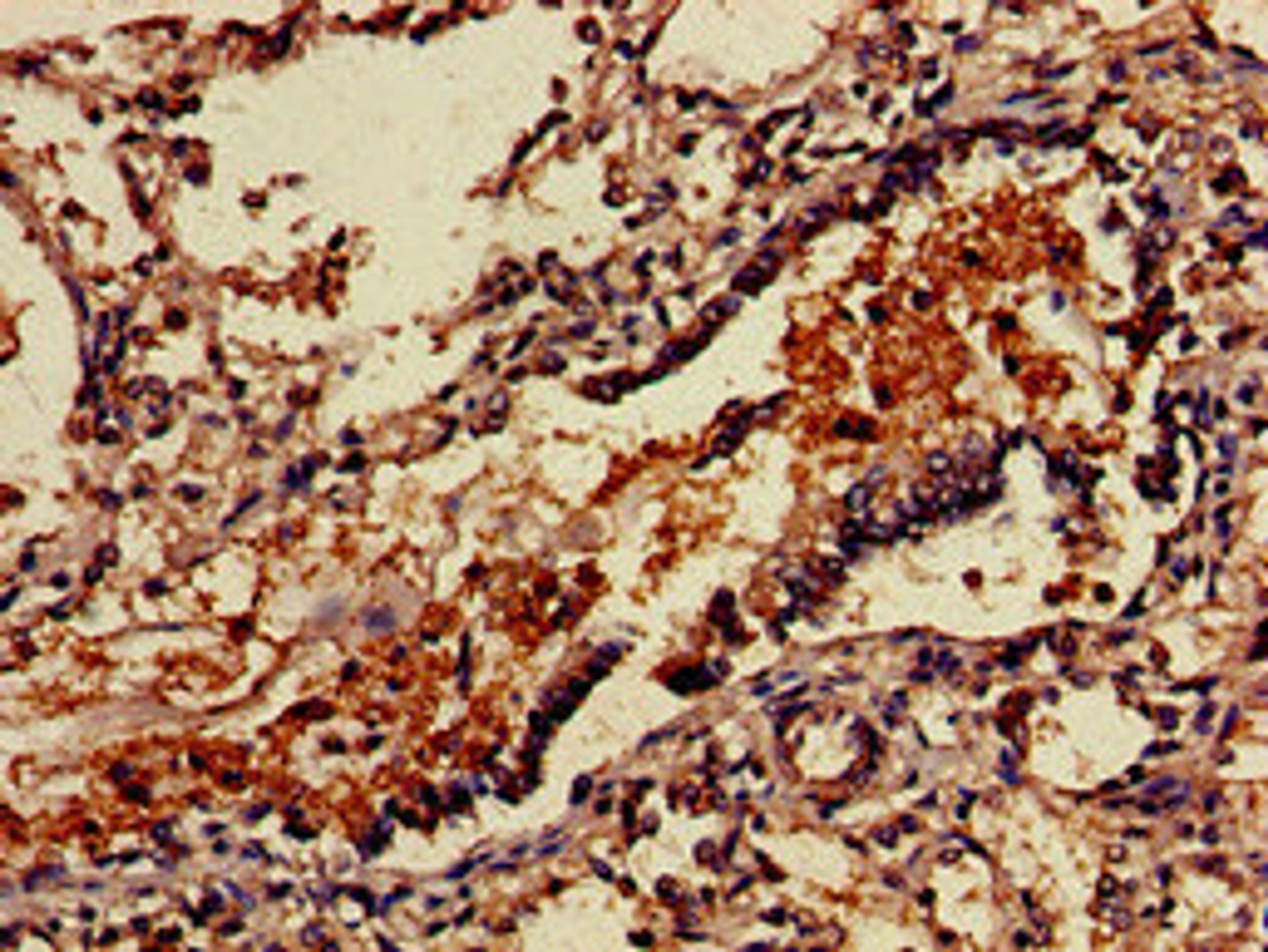 Immunohistochemistry of paraffin-embedded human lung tissue using CSB-PA896869LA01HU at dilution of 1:100