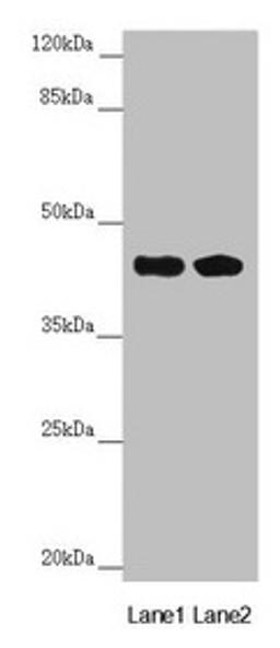 Western blot. All lanes: CEP44 antibody at 6.92µg/ml. Lane 1: Jurkat whole cell lysate. Lane 2: MCF-7 whole cell lysate. Secondary. Goat polyclonal to rabbit IgG at 1/10000 dilution. Predicted band size: 44 kDa. Observed band size: 44 kDa
