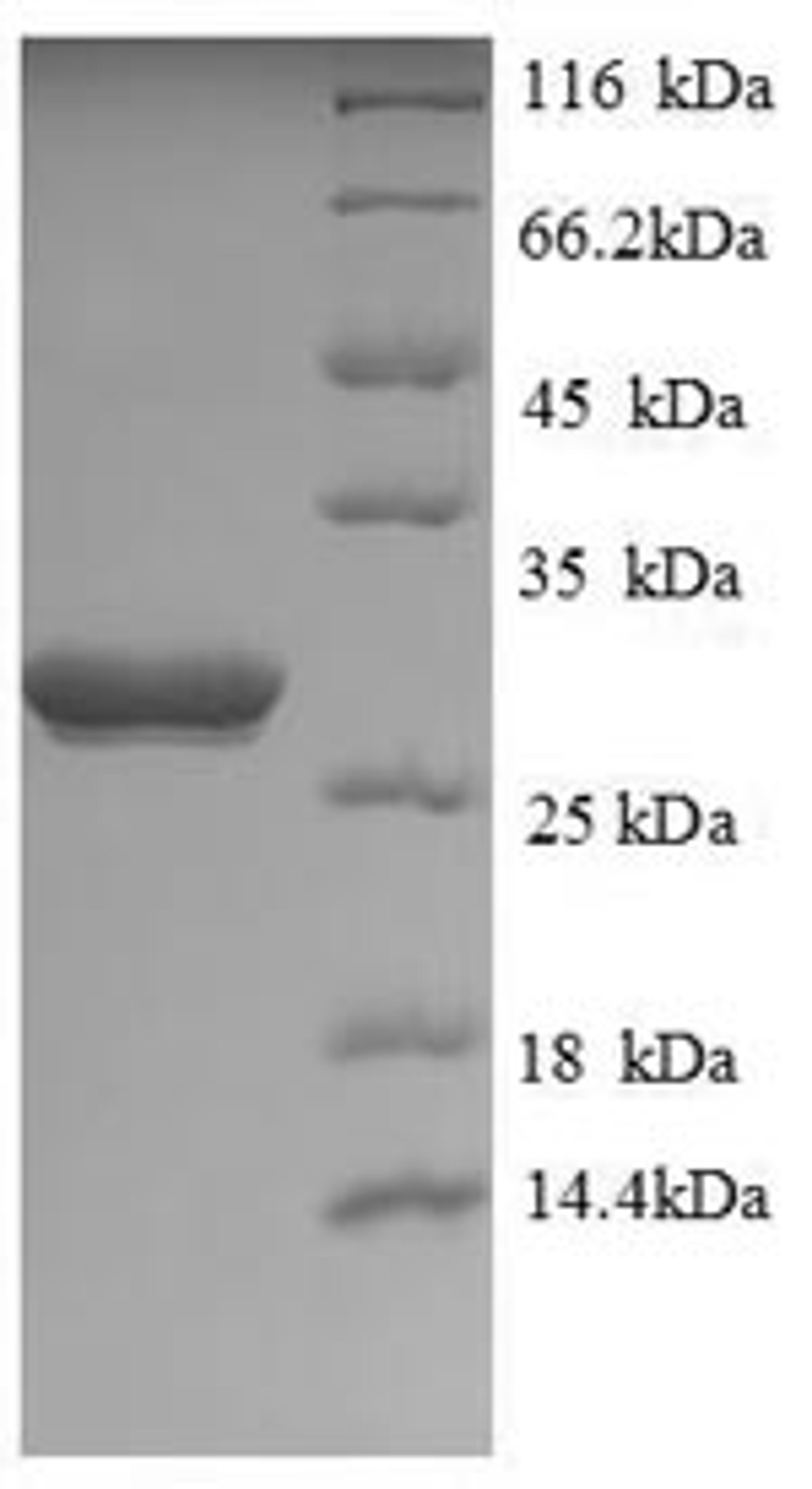 (Tris-Glycine gel) Discontinuous SDS-PAGE (reduced) with 5% enrichment gel and 15% separation gel.