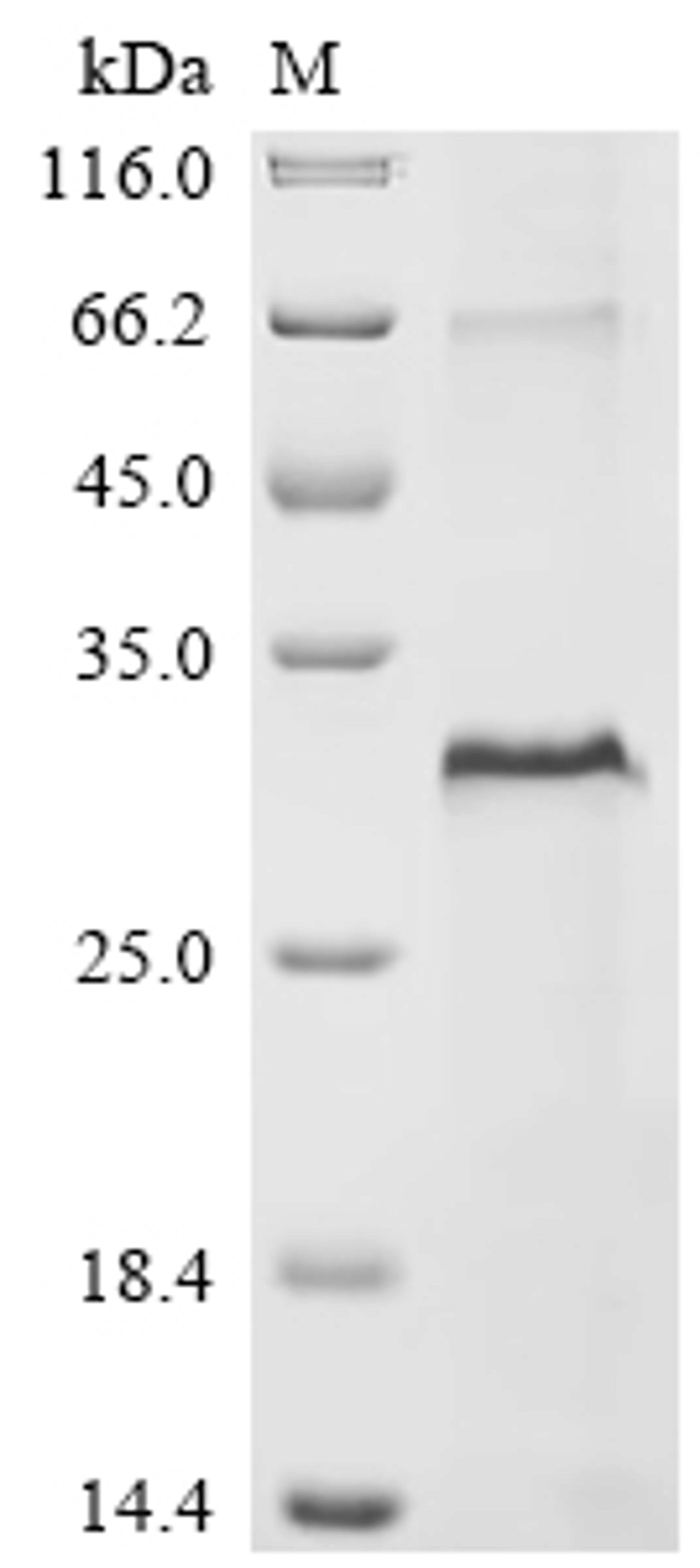 (Tris-Glycine gel) Discontinuous SDS-PAGE (reduced) with 5% enrichment gel and 15% separation gel.