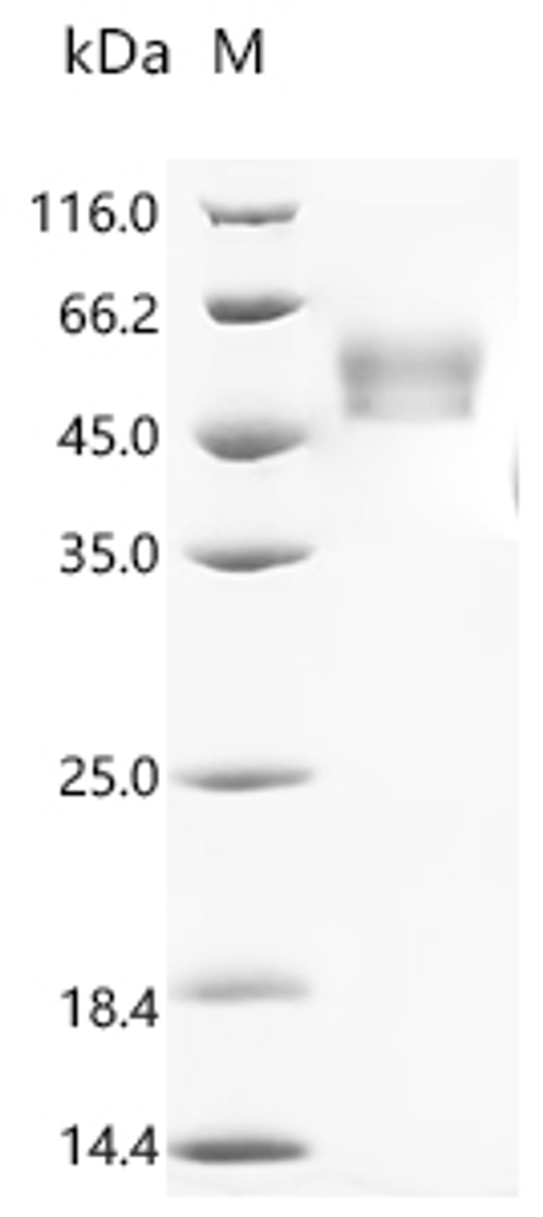 (Tris-Glycine gel) Discontinuous SDS-PAGE (reduced) with 5% enrichment gel and 15% separation gel.
