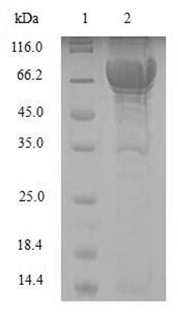 (Tris-Glycine gel) Discontinuous SDS-PAGE (reduced) with 5% enrichment gel and 15% separation gel.
