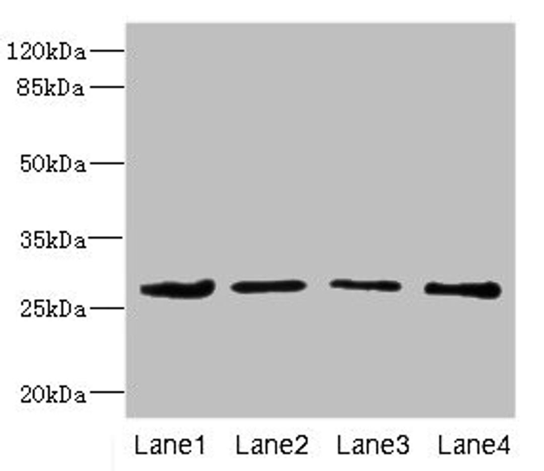 Western blot. All lanes: DCXR antibody at 2.93ug/ml. Lane 1: Mouse gonadal tissue. Lane 2: HepG2 whole cell lysate. Lane 3: A431 whole cell lysate. Lane 4: MCF-7 whole cell lysate. Secondary. Goat polyclonal to rabbit IgG at 1/10000 dilution. Predicted band size: 26 kDa. Observed band size: 26 kDa. 