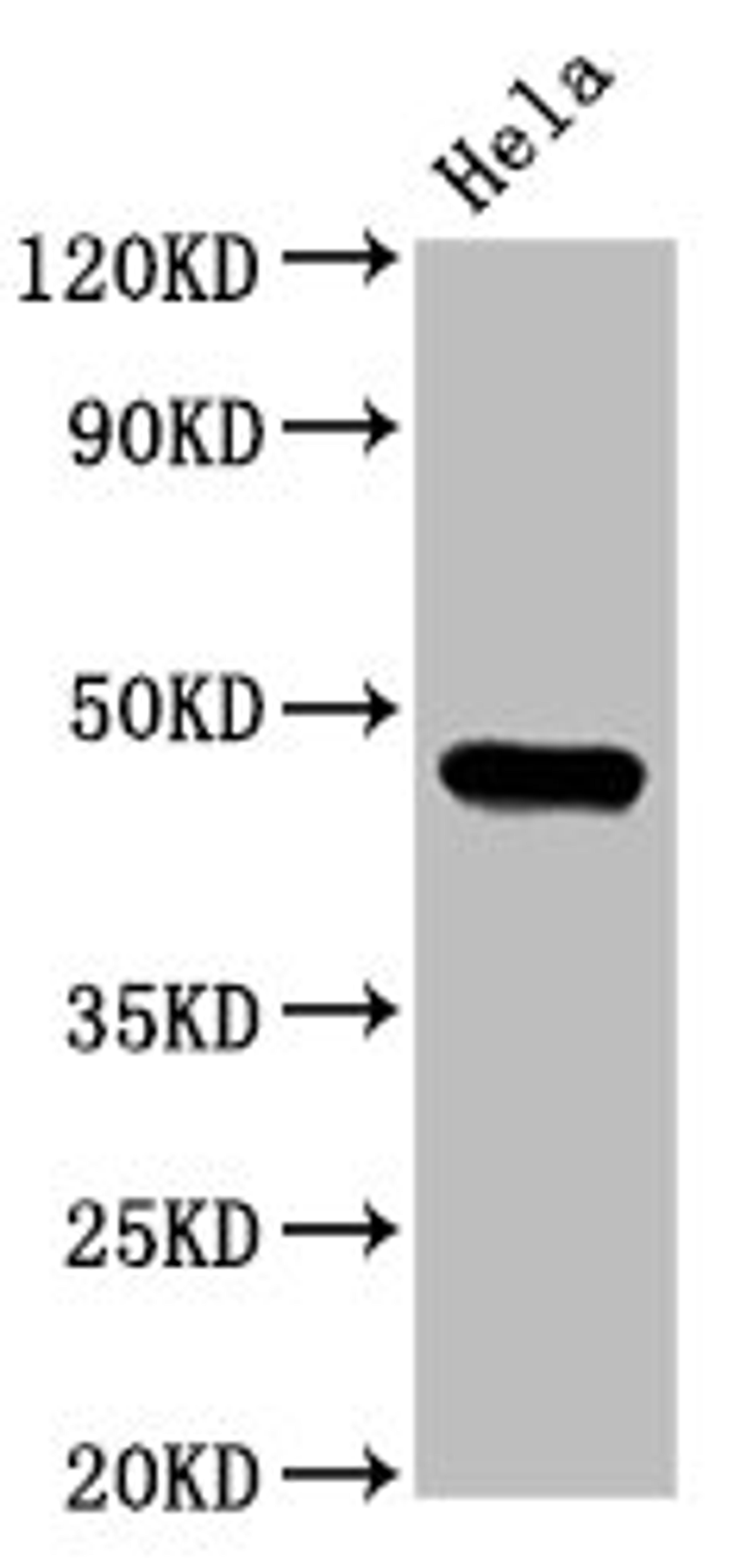Western Blot. Positive WB detected in: Hela whole cell lysate. All lanes: CSNK1E antibody at 3.2µg/ml. Secondary. Goat polyclonal to rabbit IgG at 1/50000 dilution. Predicted band size: 48 kDa. Observed band size: 48 kDa