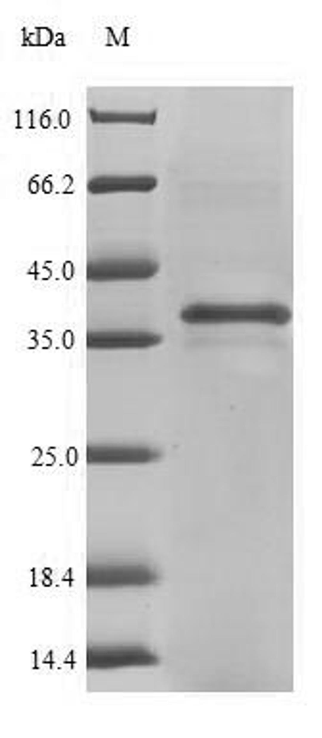 (Tris-Glycine gel) Discontinuous SDS-PAGE (reduced) with 5% enrichment gel and 15% separation gel.