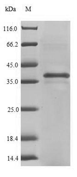 (Tris-Glycine gel) Discontinuous SDS-PAGE (reduced) with 5% enrichment gel and 15% separation gel.