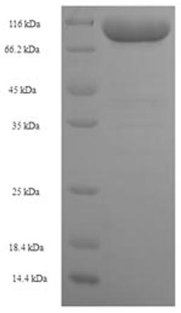 (Tris-Glycine gel) Discontinuous SDS-PAGE (reduced) with 5% enrichment gel and 15% separation gel.