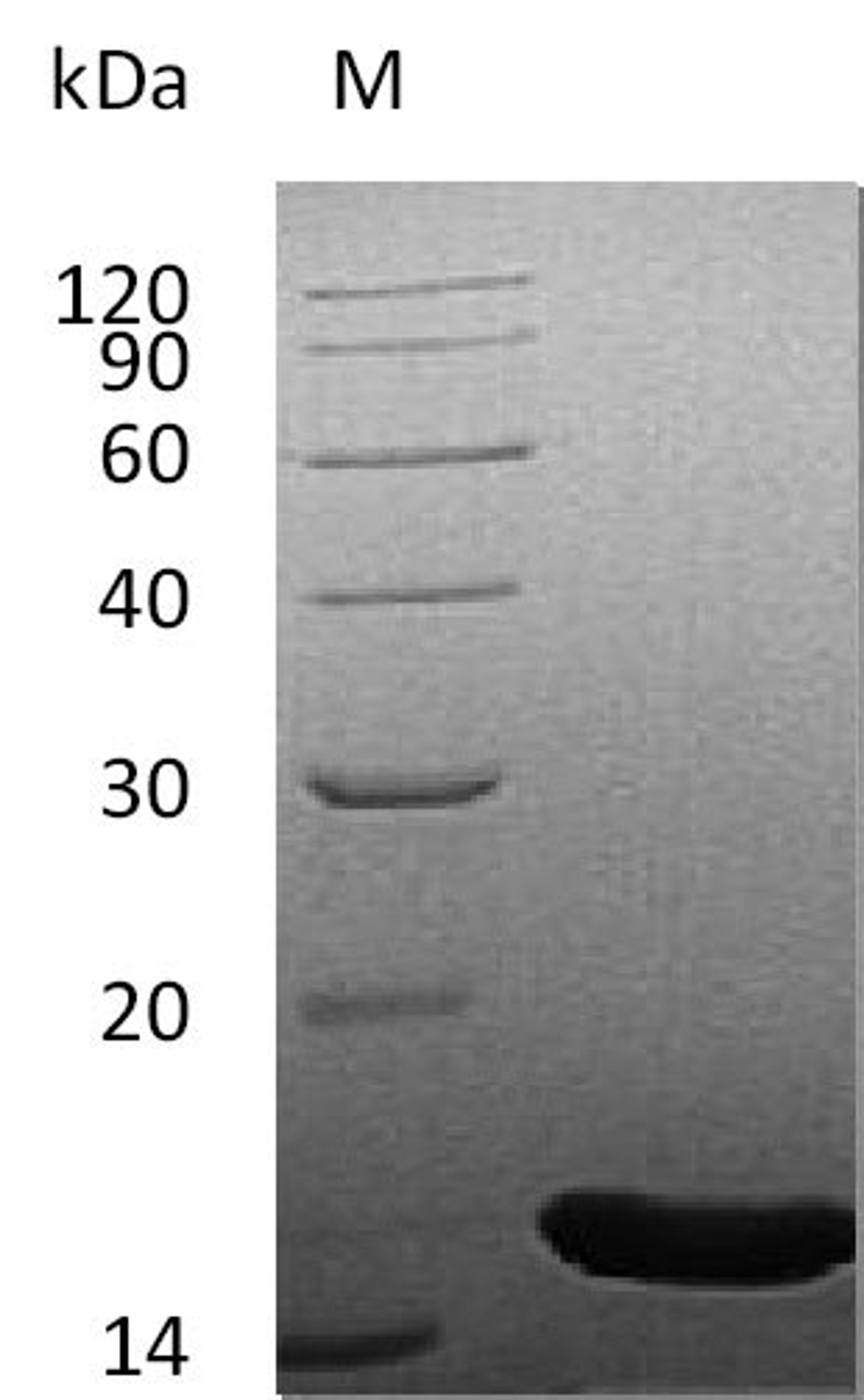 (Tris-Glycine gel) Discontinuous SDS-PAGE (reduced) with 5% enrichment gel and 15% separation gel.