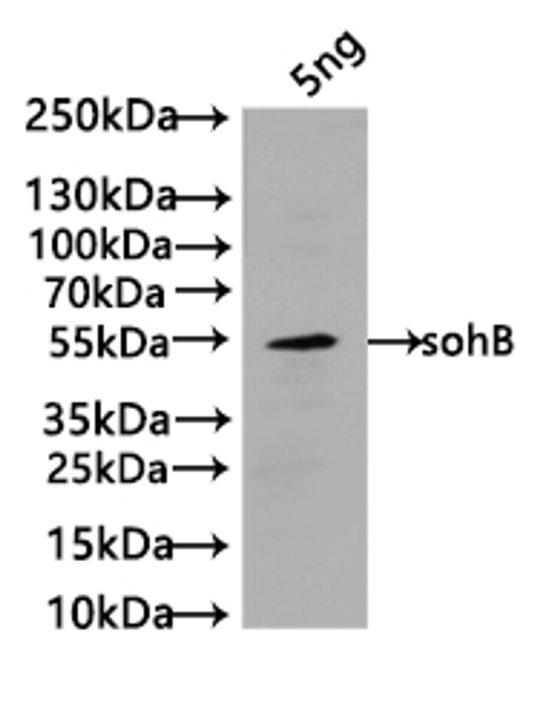 Western Blot. Positive WB detected in: recombinant protein. All lanes:sohB Antibody at 1:1000. Secondary. Goat polyclonal to rabbit IgG at 1/50000 dilution. Predicted band size: 52 kDa. Observed band size: 52 kDa. 
