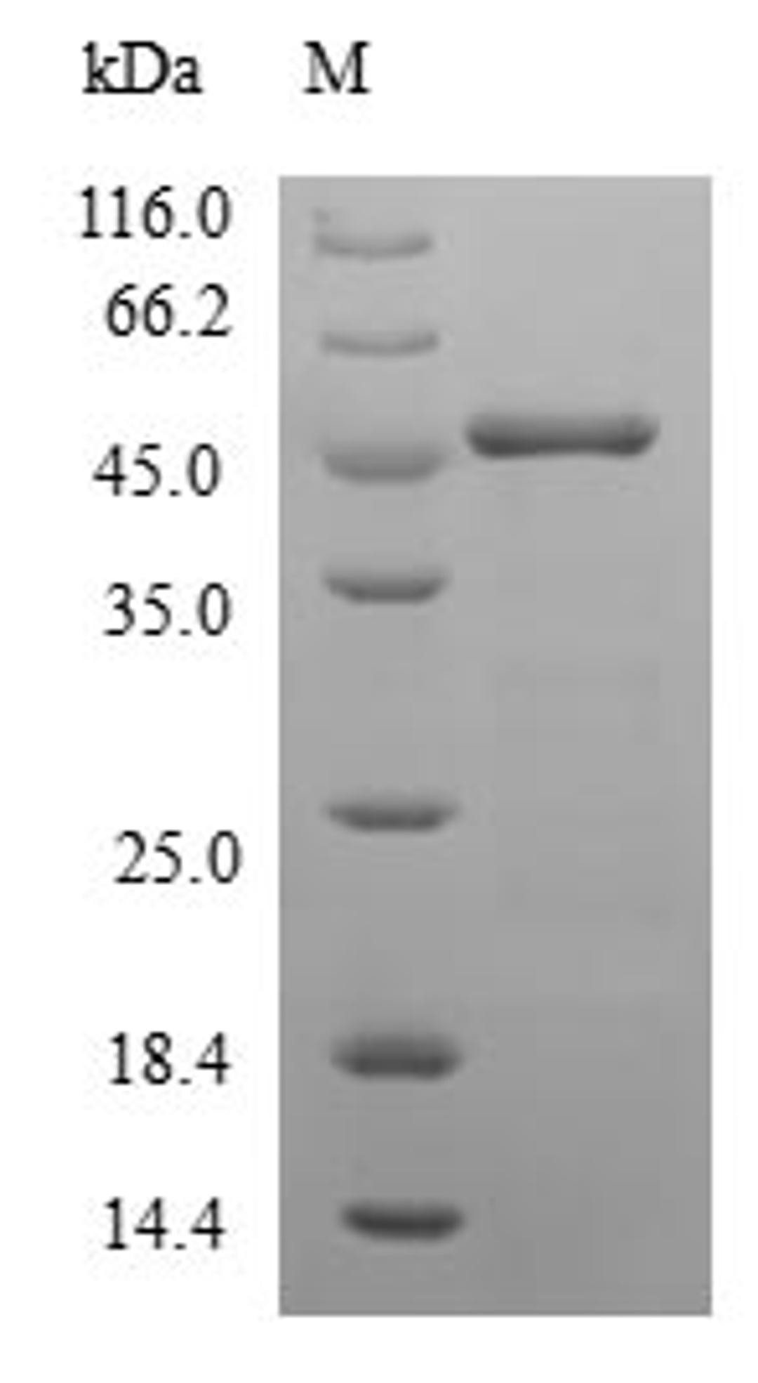 (Tris-Glycine gel) Discontinuous SDS-PAGE (reduced) with 5% enrichment gel and 15% separation gel.