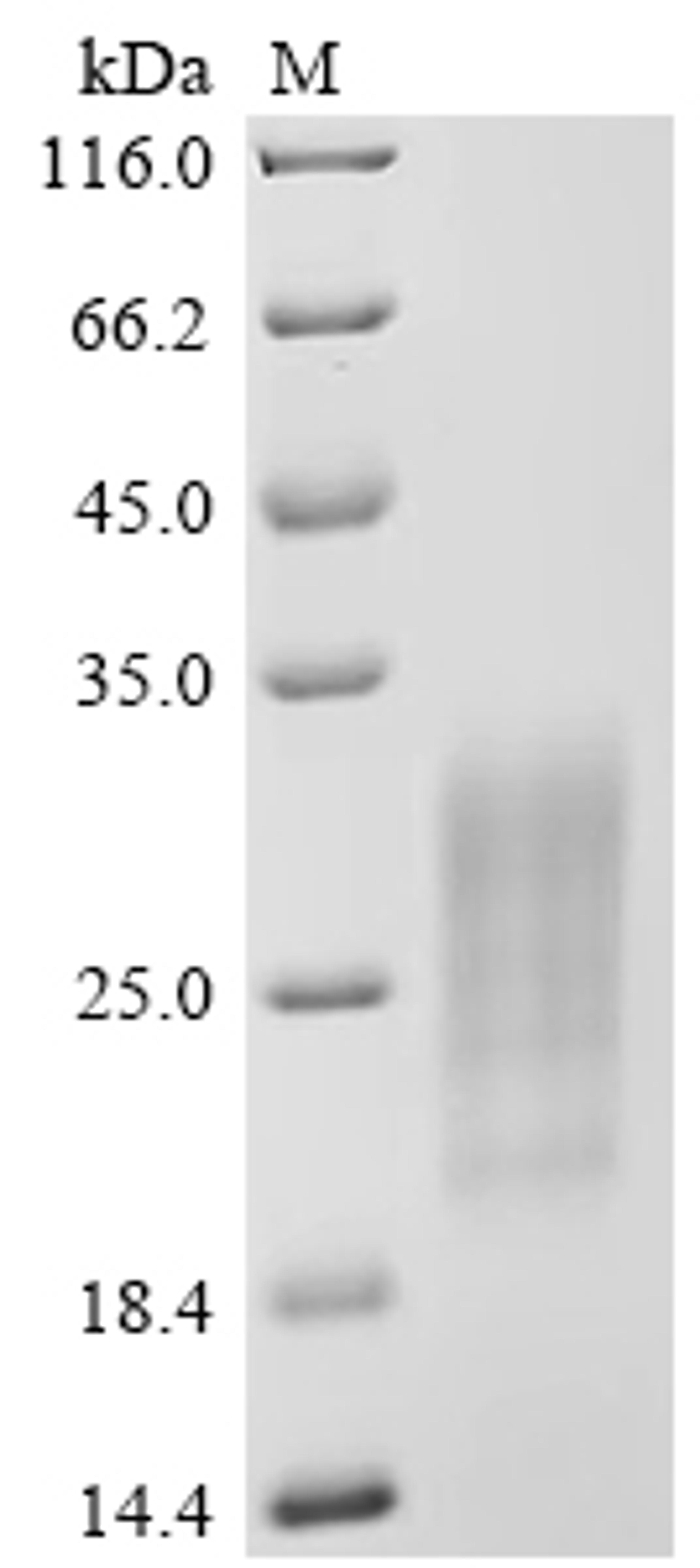 (Tris-Glycine gel) Discontinuous SDS-PAGE (reduced) with 5% enrichment gel and 15% separation gel.