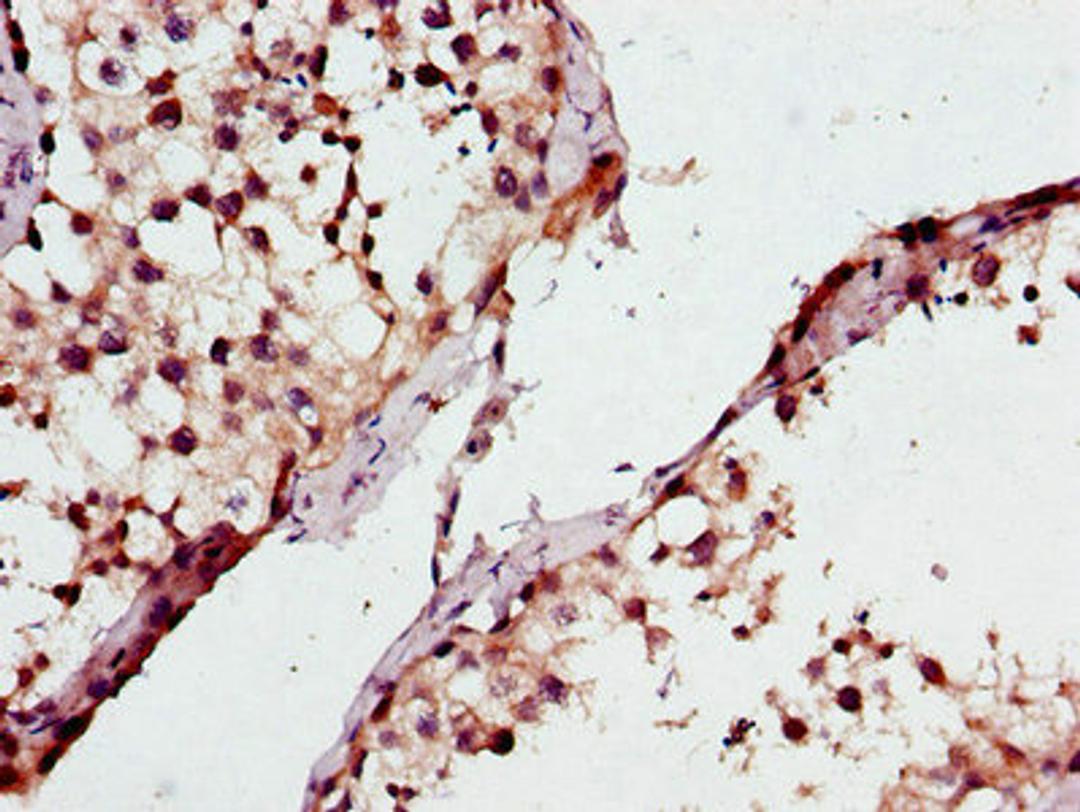 Immunohistochemistry of paraffin-embedded human testis tissue using CSB-PA865134LA01HU at dilution of 1:100