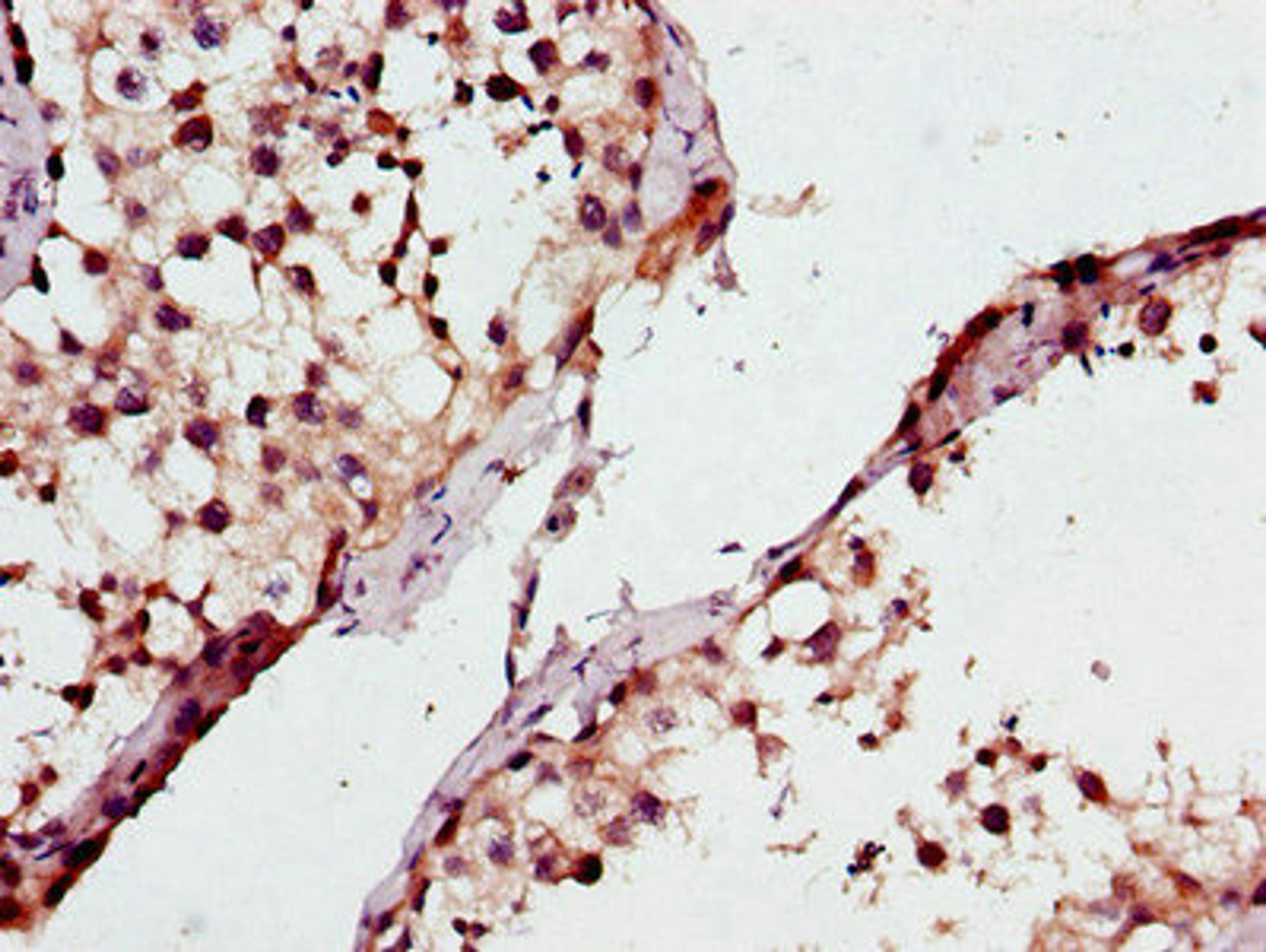 Immunohistochemistry of paraffin-embedded human testis tissue using CSB-PA865134LA01HU at dilution of 1:100