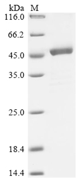 (Tris-Glycine gel) Discontinuous SDS-PAGE (reduced) with 5% enrichment gel and 15% separation gel.