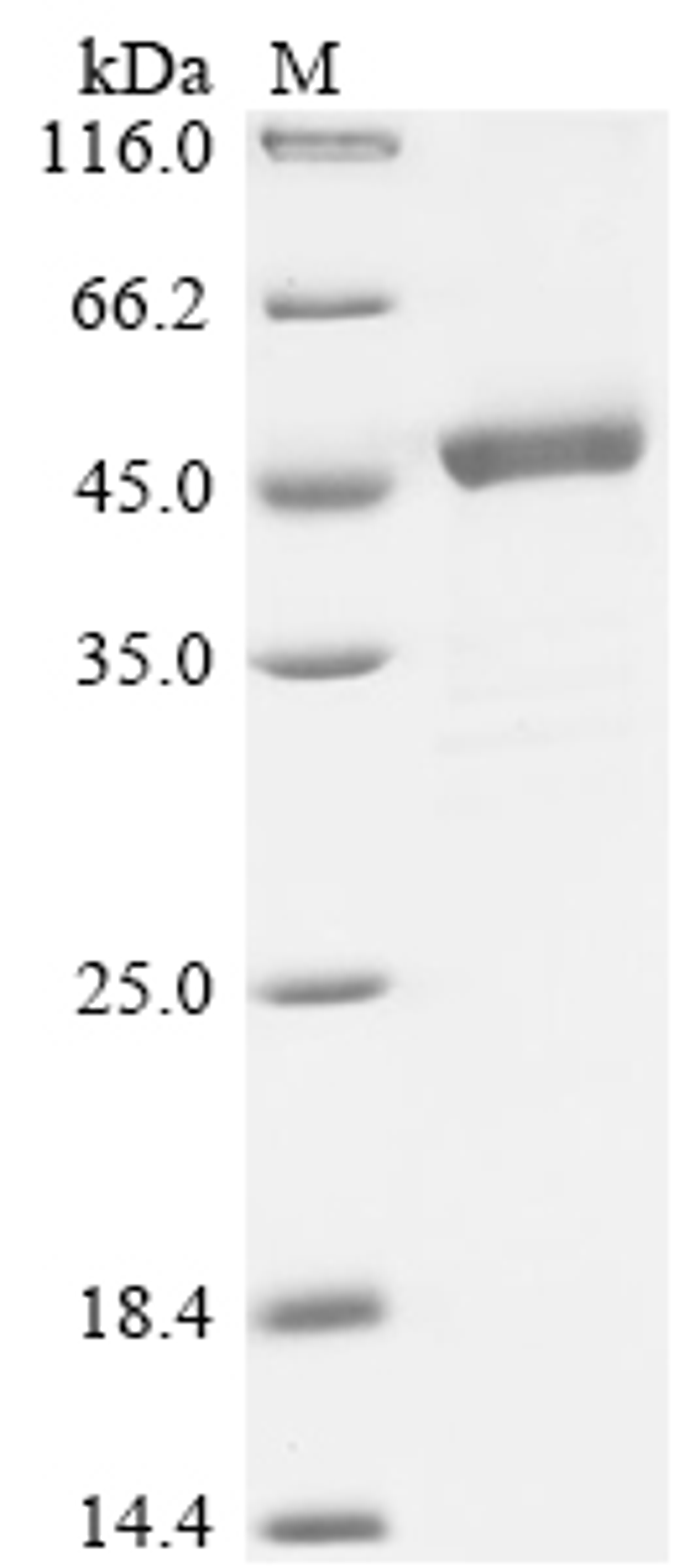 (Tris-Glycine gel) Discontinuous SDS-PAGE (reduced) with 5% enrichment gel and 15% separation gel.