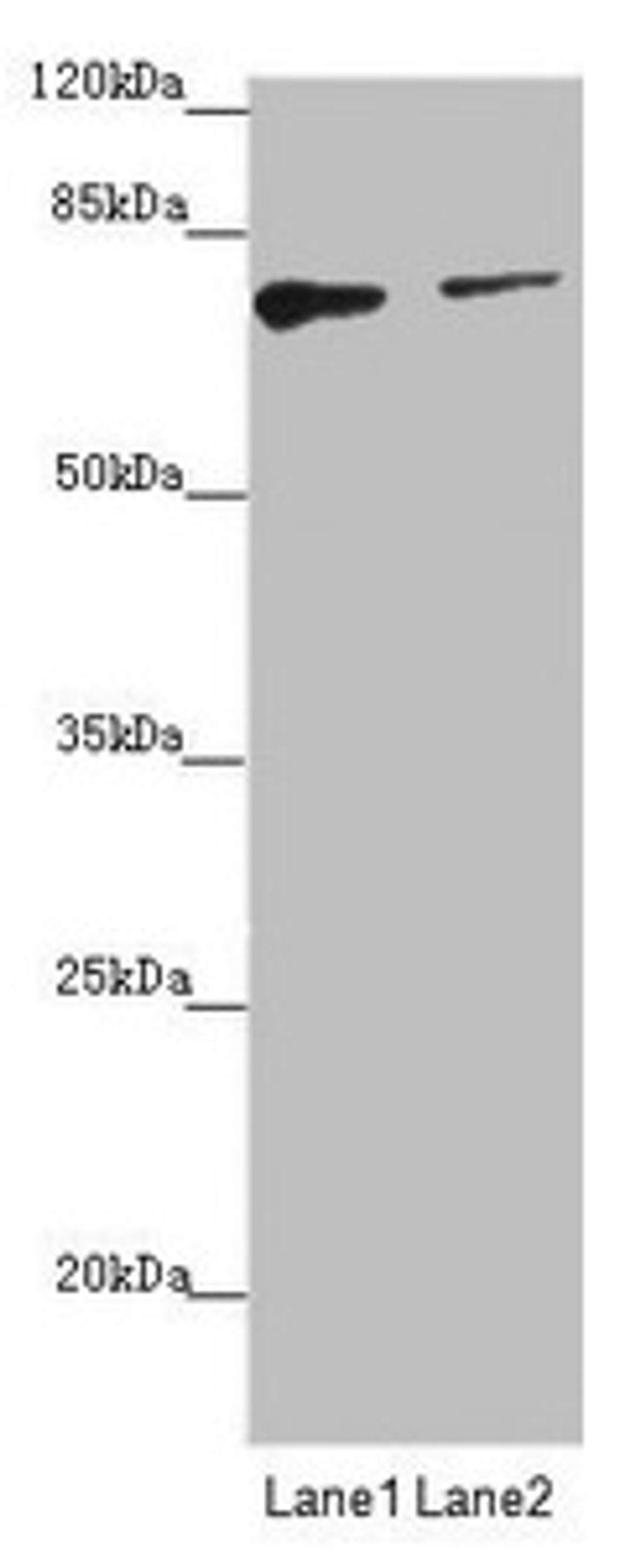 Western blot. All lanes: SCFD1 antibody at 2.92µg/ml. Lane 1: Hela whole cell lysate. Lane 2: A549 whole cell lysate. Secondary. Goat polyclonal to rabbit IgG at 1/10000 dilution. Predicted band size: 73, 63, 66 kDa. Observed band size: 73 kDa