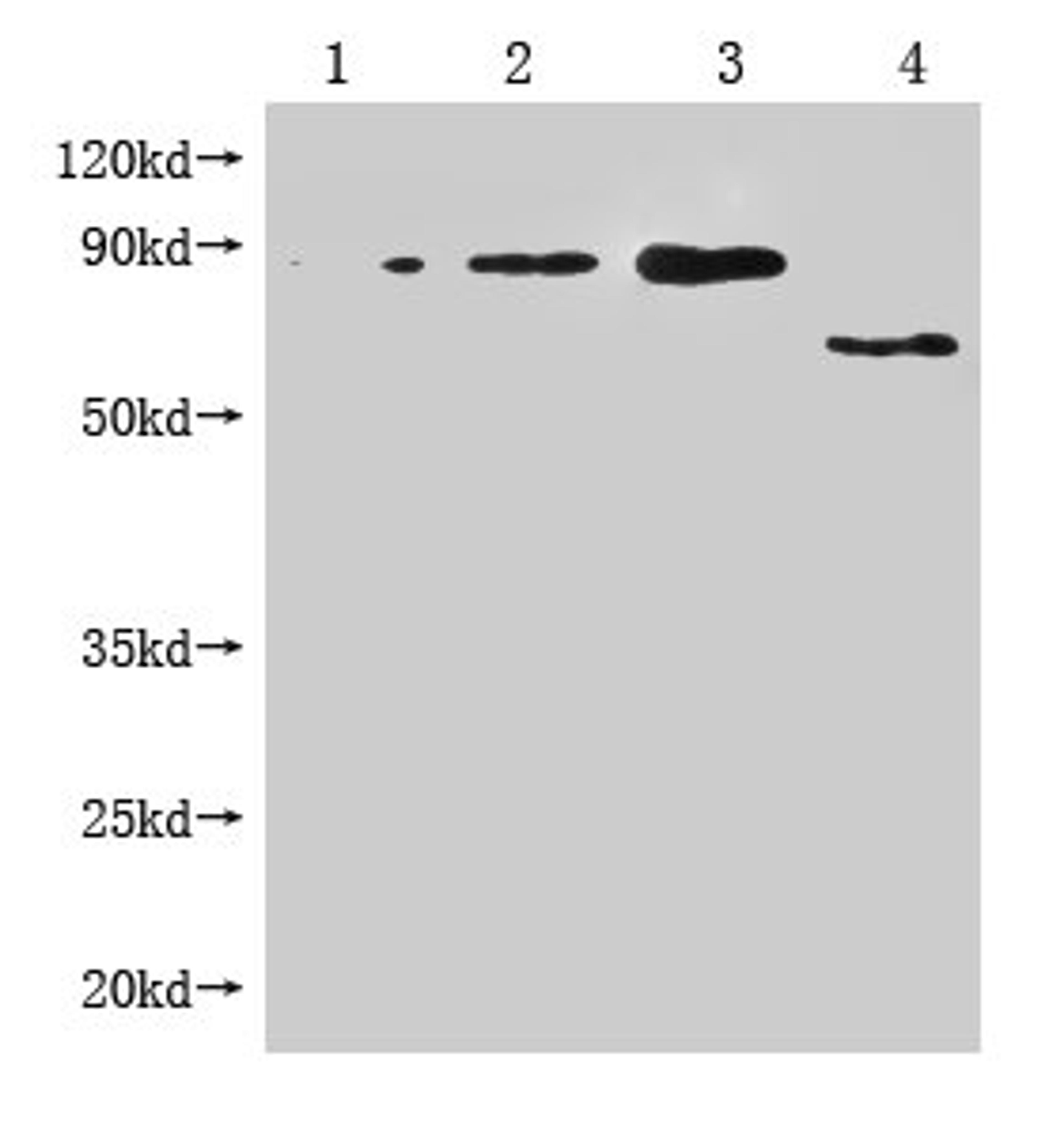 Western Blot. Positive WB detected in: 1-3 lanes: Recombinant Enterobacteria phage M13 Attachment protein at 5ng, 10ng, 20ng; 4 lane: Enterobacteria phage M13 Attachment. All lanes: Enterobacteria phage M13 III antibody at 1:1000. Secondary. Goat polyclonal to mouse IgG at 1/50000 dilution. Predicted band size: 65, 55-70 KDa. Observed band size: 65, 55-70 KDa. Exposure time：3min