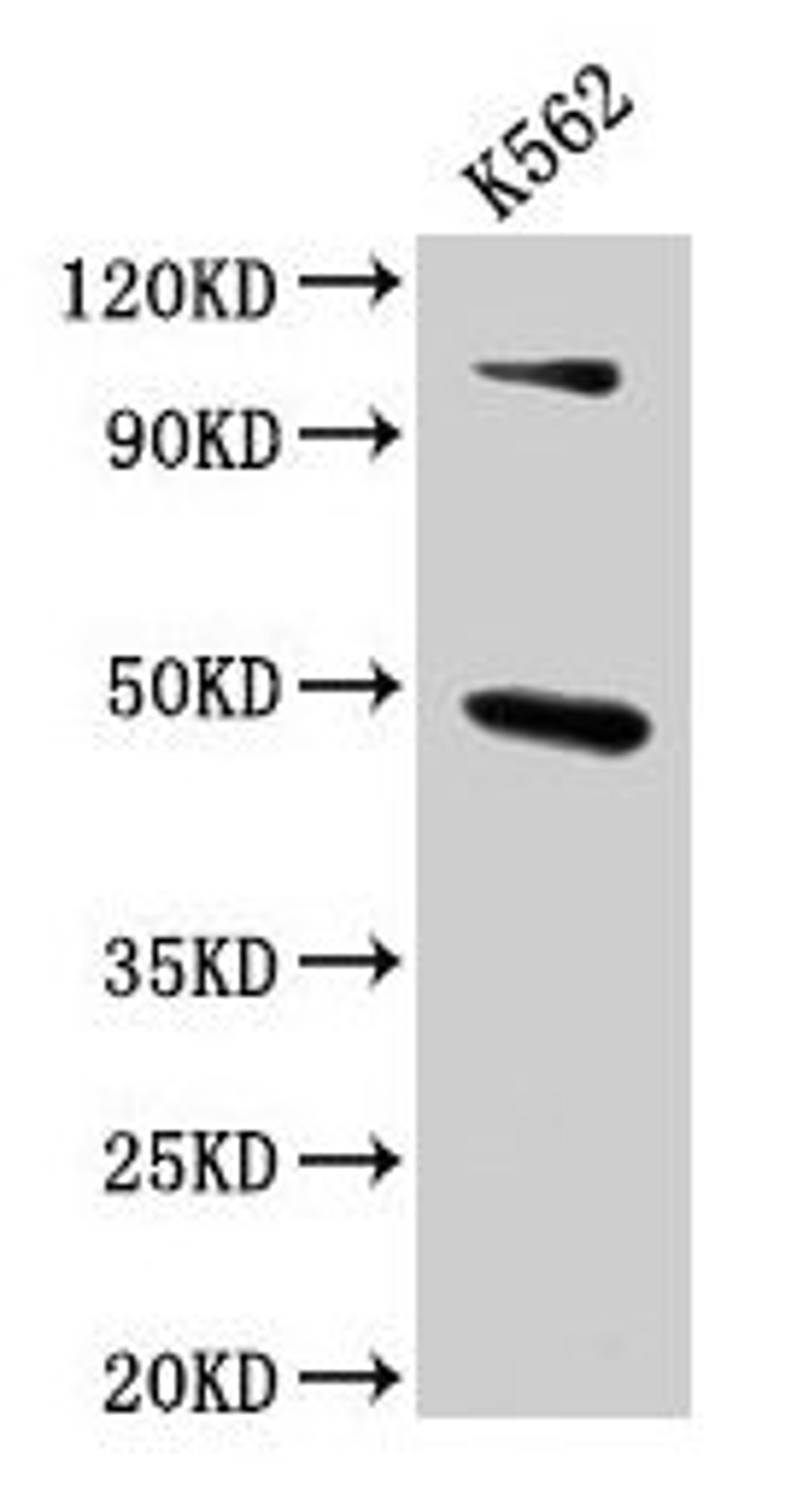 Western Blot. Positive WB detected in: K562 whole cell lysate. All lanes: ARRB1 antibody at 4.6µg/ml. Secondary. Goat polyclonal to rabbit IgG at 1/50000 dilution. Predicted band size: 48, 47 kDa. Observed band size: 48 kDa