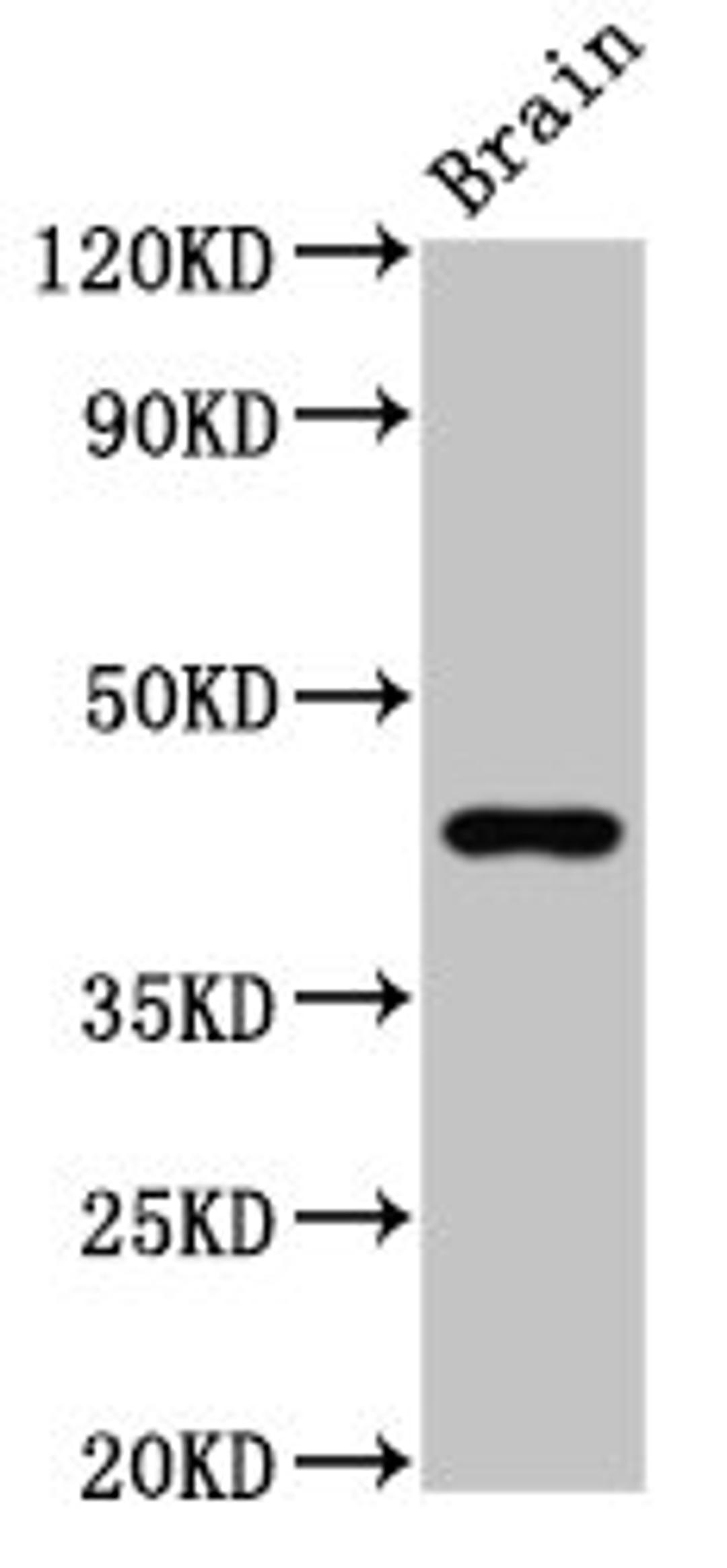 Western Blot. Positive WB detected in: Rat brain tissue. All lanes: GPR14 antibody at 3.7ug/ml. Secondary. Goat polyclonal to rabbit IgG at 1/50000 dilution. Predicted band size: 44 kDa. Observed band size: 44 kDa. 
