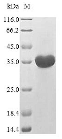(Tris-Glycine gel) Discontinuous SDS-PAGE (reduced) with 5% enrichment gel and 15% separation gel.