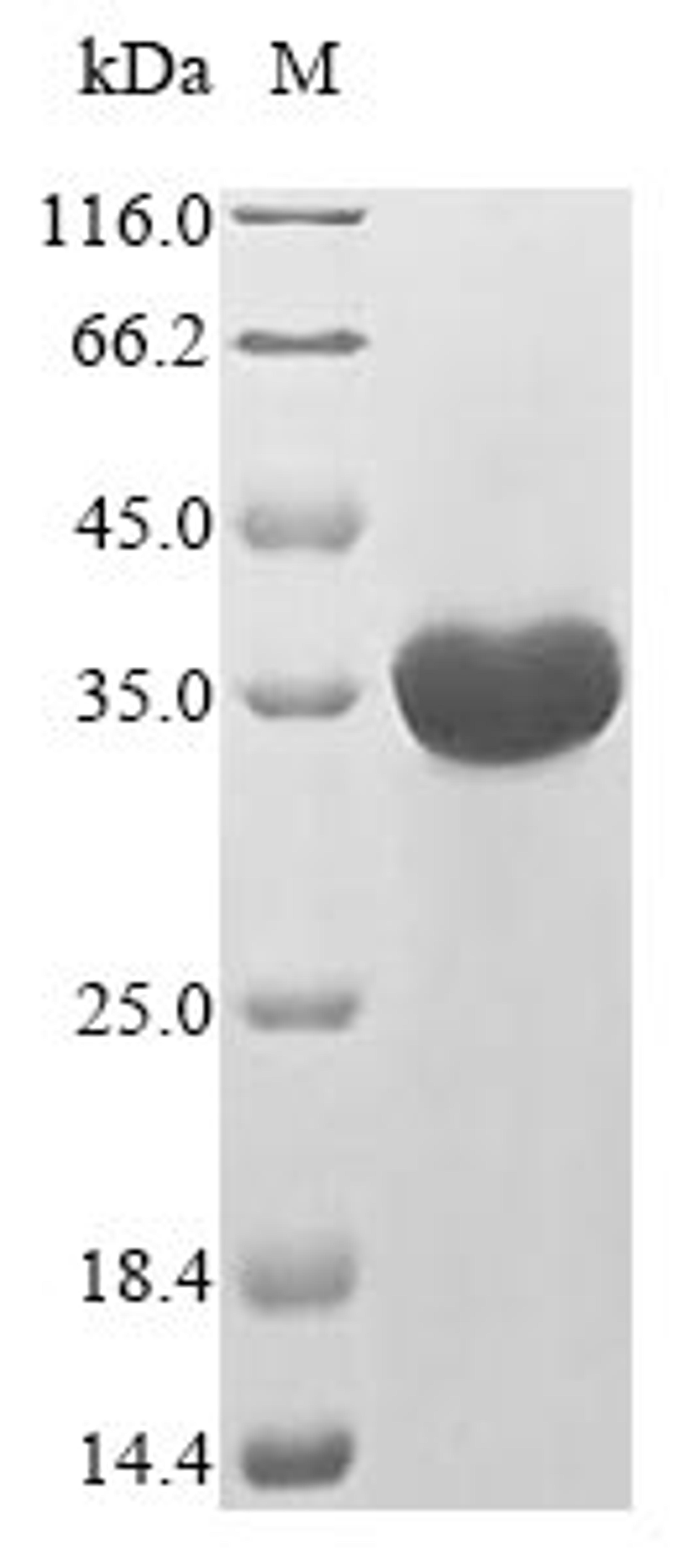 (Tris-Glycine gel) Discontinuous SDS-PAGE (reduced) with 5% enrichment gel and 15% separation gel.