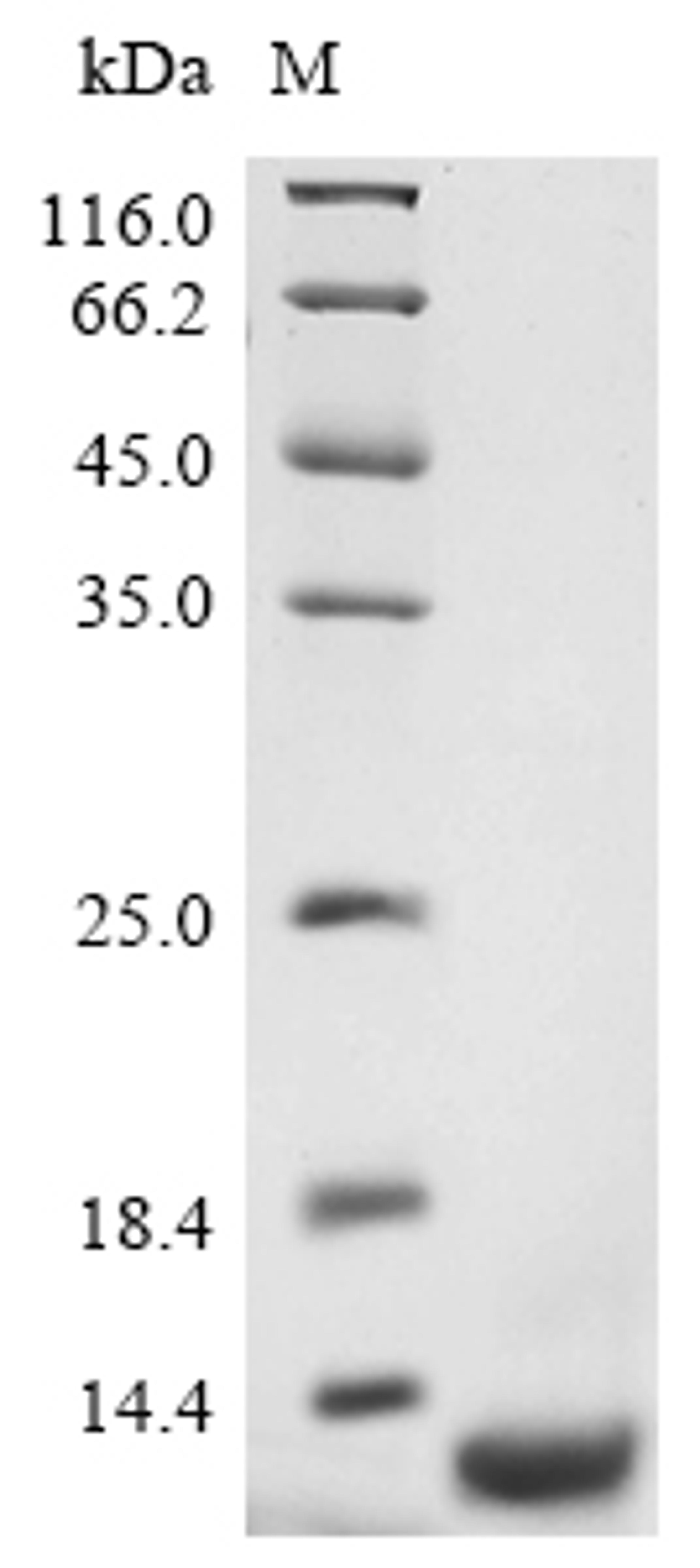 (Tris-Glycine gel) Discontinuous SDS-PAGE (reduced) with 5% enrichment gel and 15% separation gel.