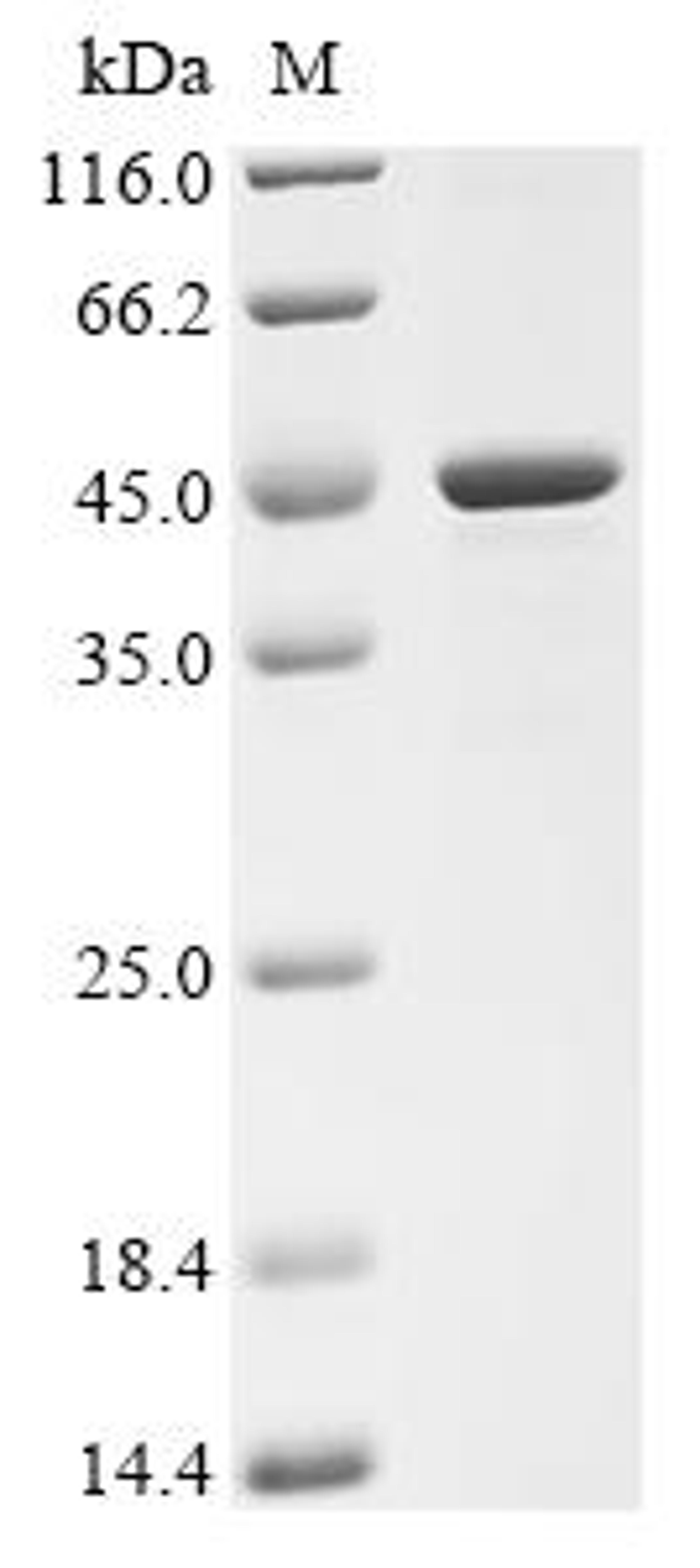 (Tris-Glycine gel) Discontinuous SDS-PAGE (reduced) with 5% enrichment gel and 15% separation gel.