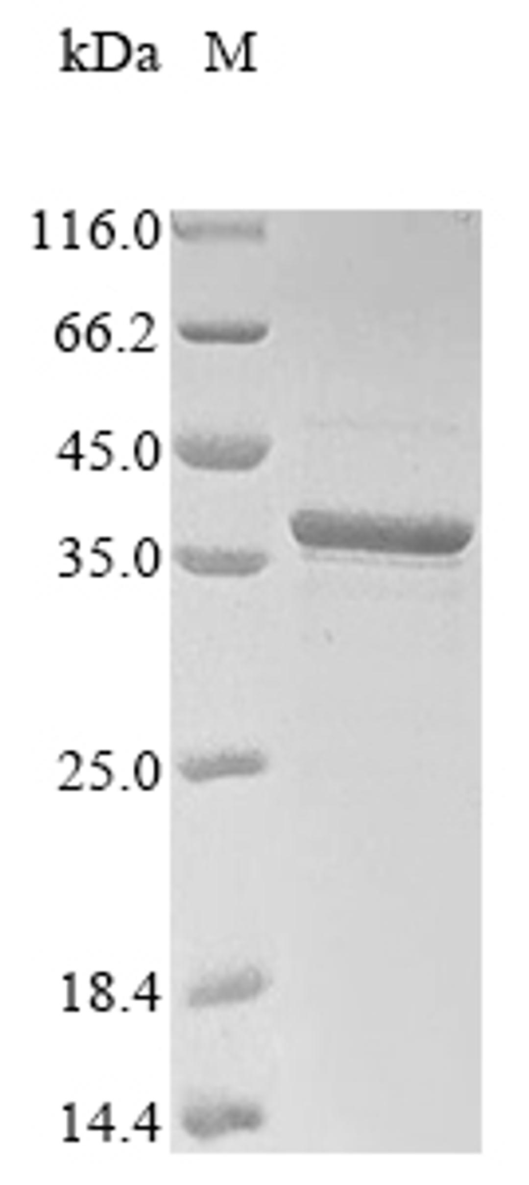 (Tris-Glycine gel) Discontinuous SDS-PAGE (reduced) with 5% enrichment gel and 15% separation gel.