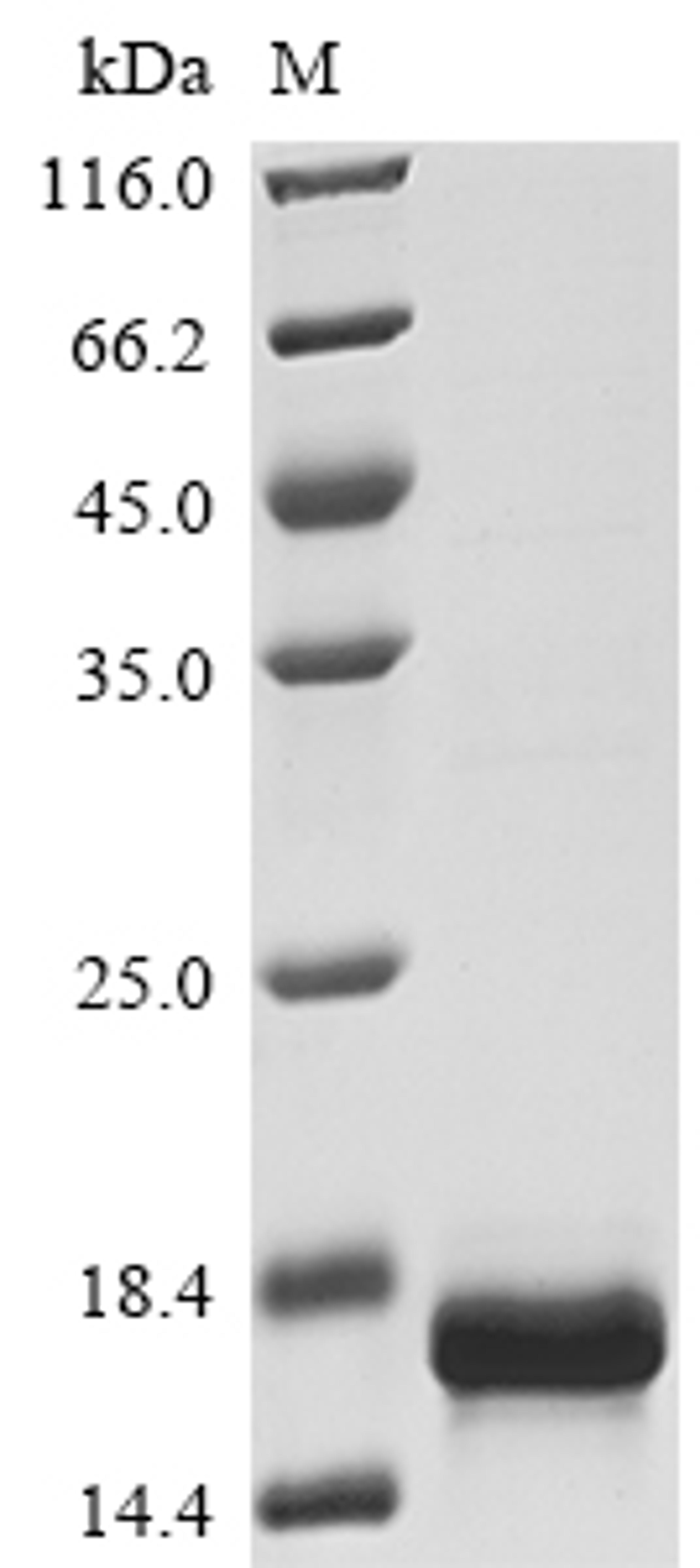 (Tris-Glycine gel) Discontinuous SDS-PAGE (reduced) with 5% enrichment gel and 15% separation gel.